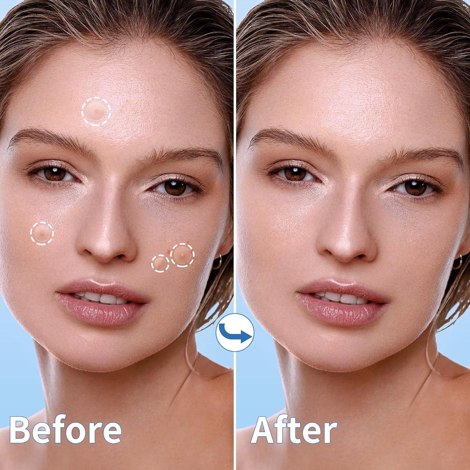 Parche para Granos Daolyo 300 Cuentas Hidrocoloide