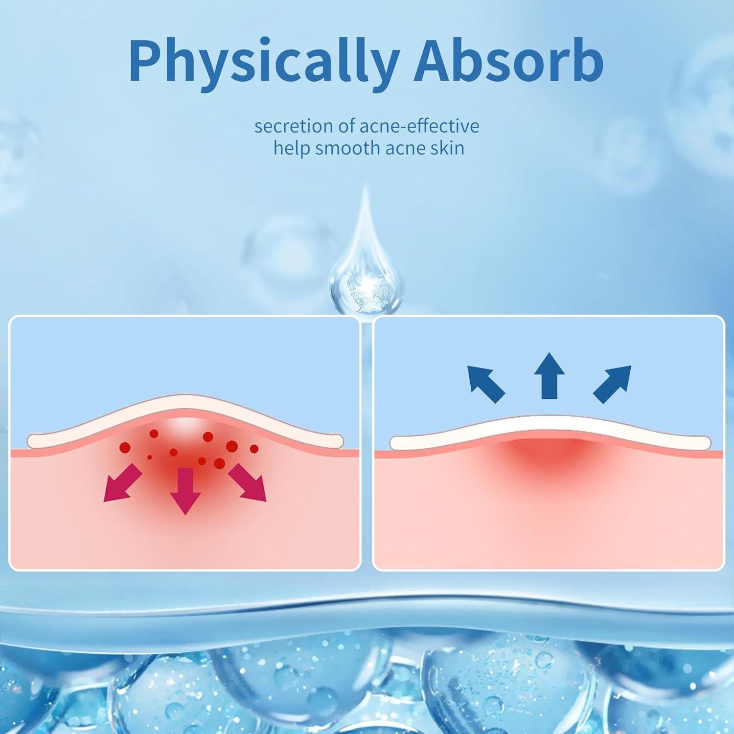 Parche para Granos Daolyo 300 Cuentas Hidrocoloide