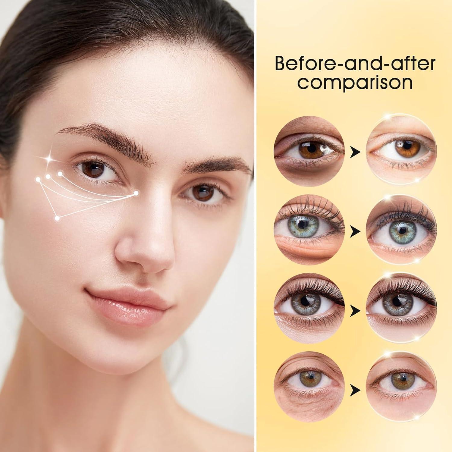 Parches para Ojos Adofect 30 Pares Oro Colágeno Hidratantes