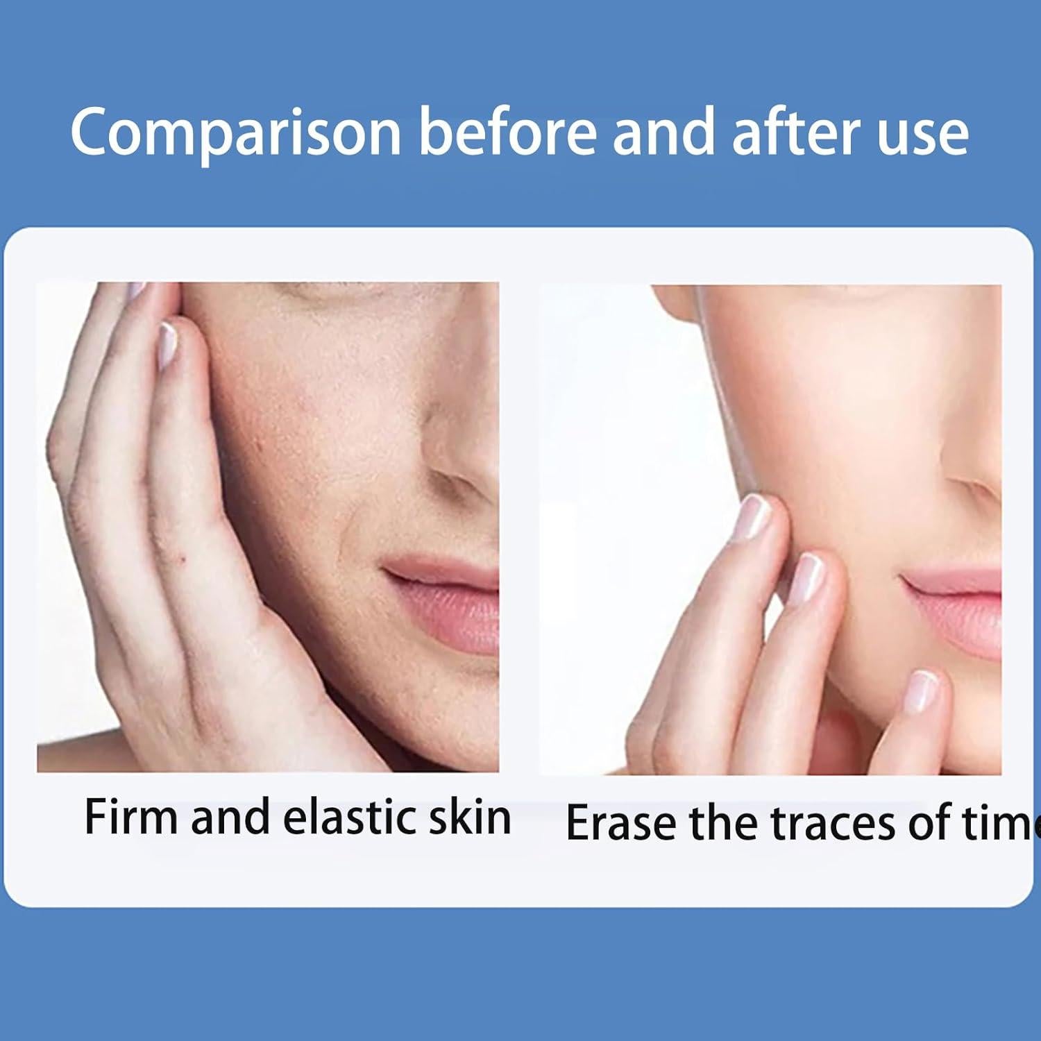 Parches Antiarrugas VolksRose Silicona Reutilizables 3 Pzas