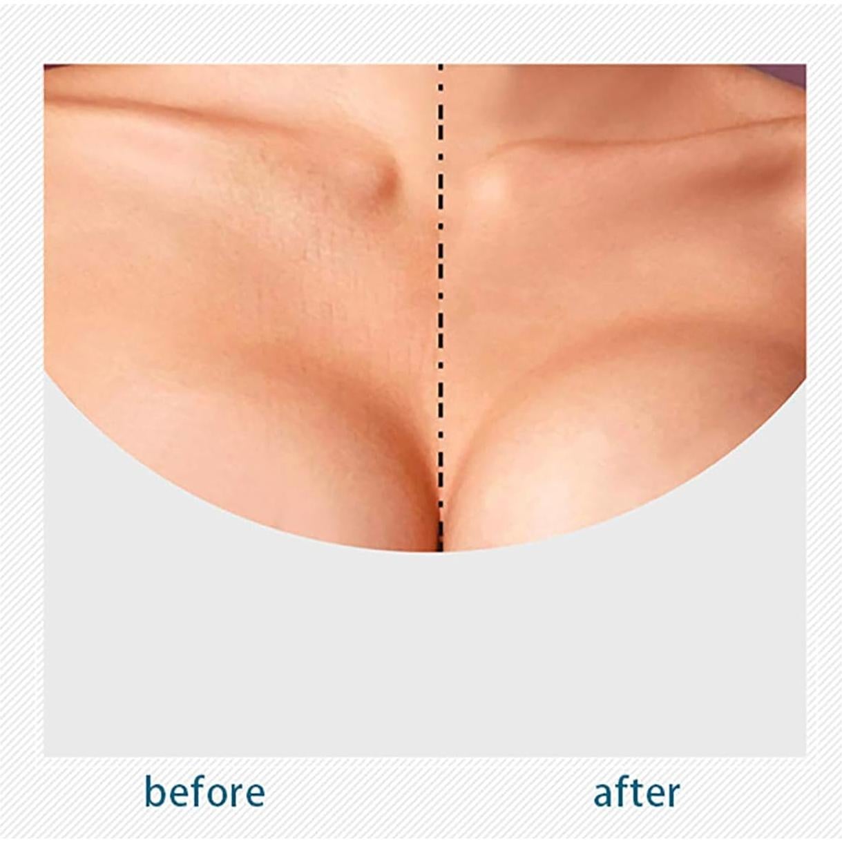 Parches Antiarrugas VolksRose Silicona Reutilizables 3 Pzas