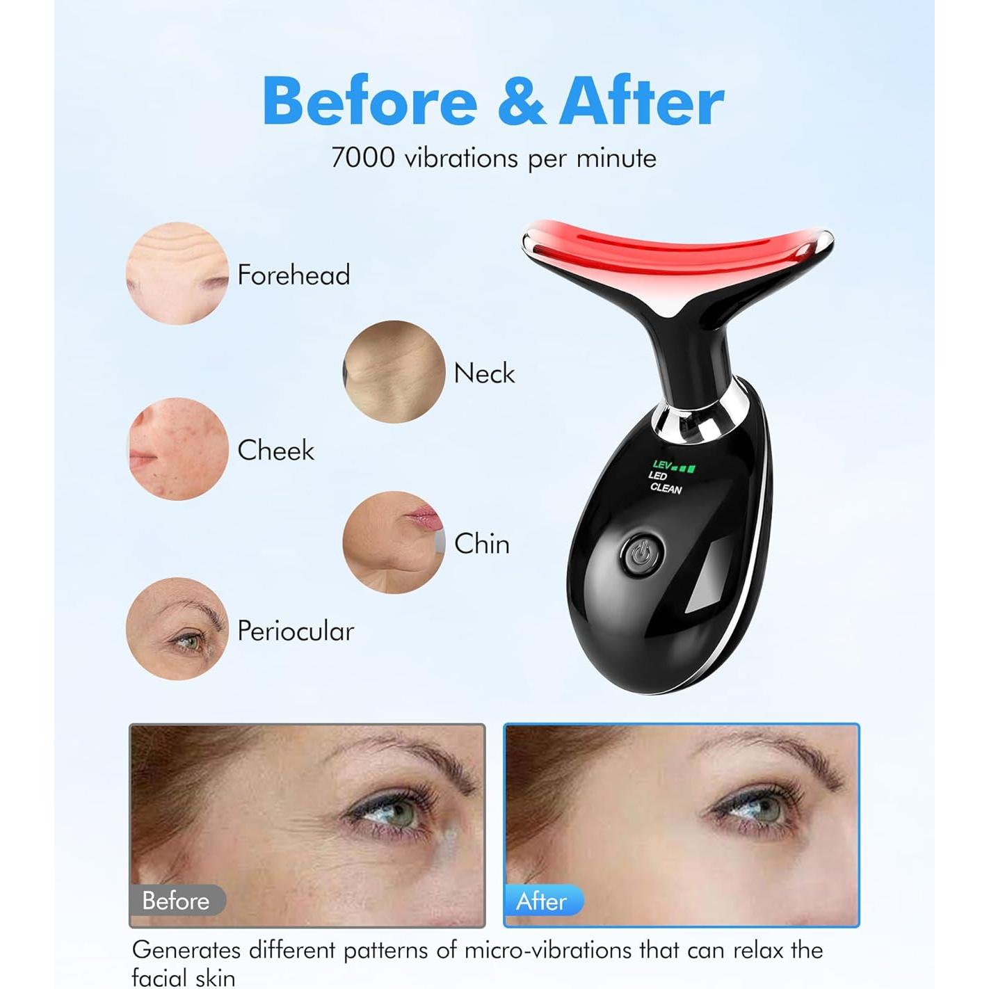 Masajeador Facial Sunpint ES-1081 7 Colores y Térmico