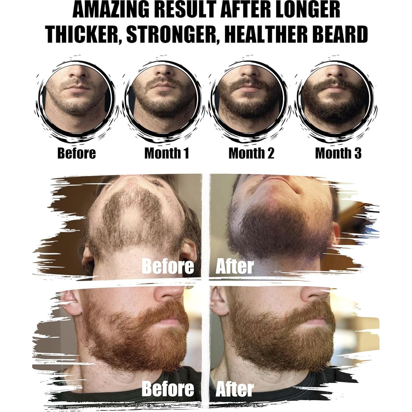 Kit de Barba Isner Mile 11 Piezas Sándalo Cuidado Completo