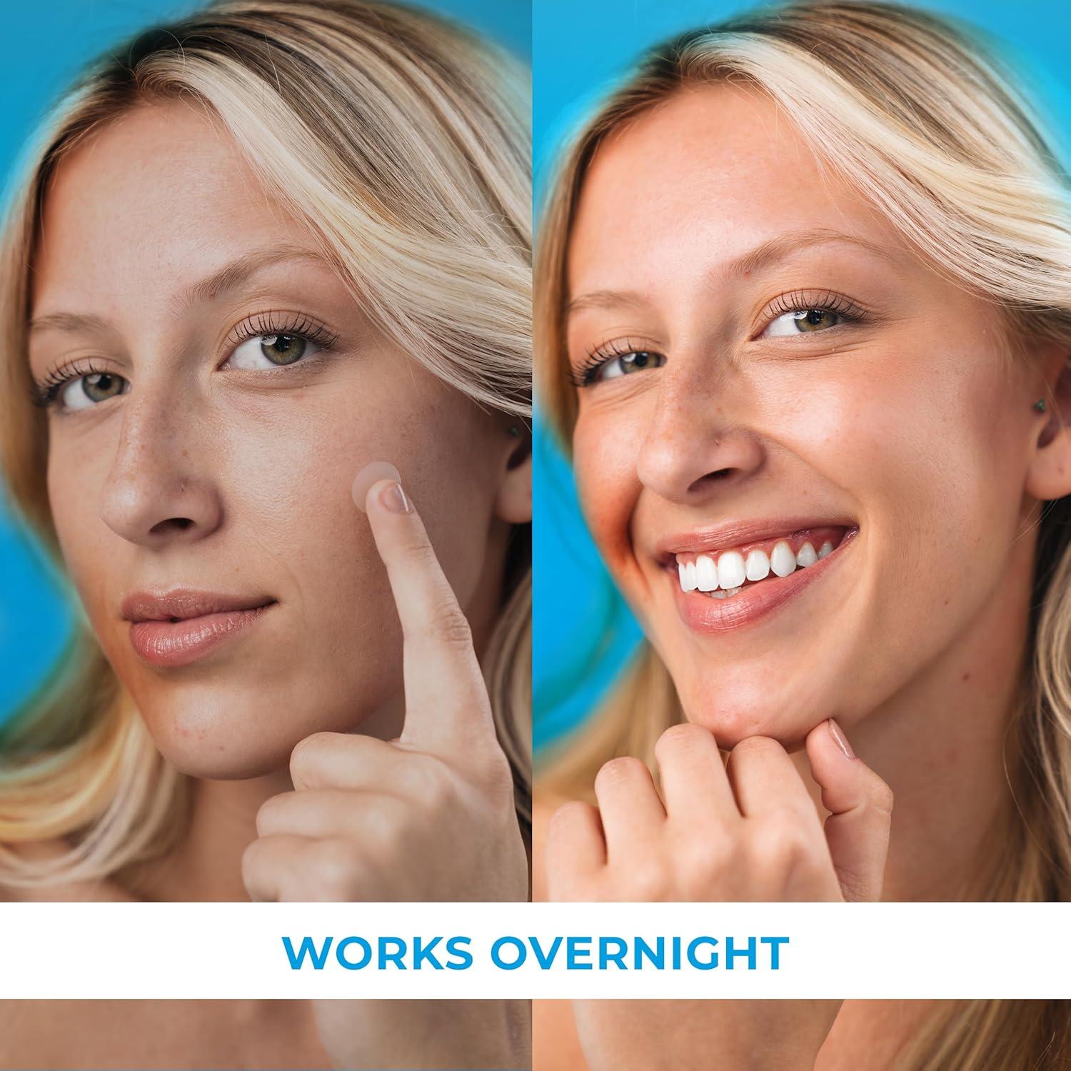 Parches para Granos PatchRx 120 unidades Hidrocoloides