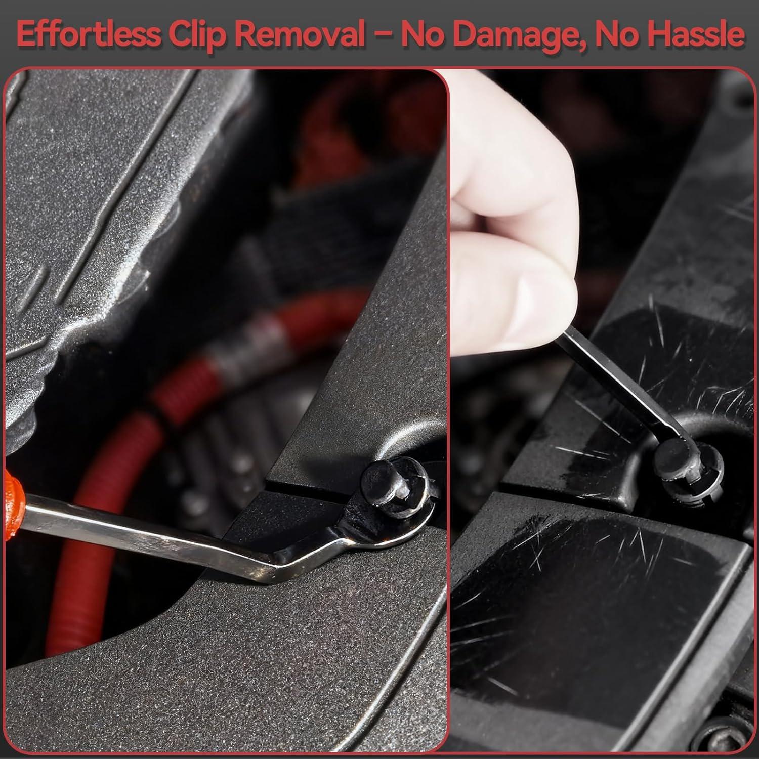 Kit de Clips de Retención de Coche 415PCS - Sujetadores Universales