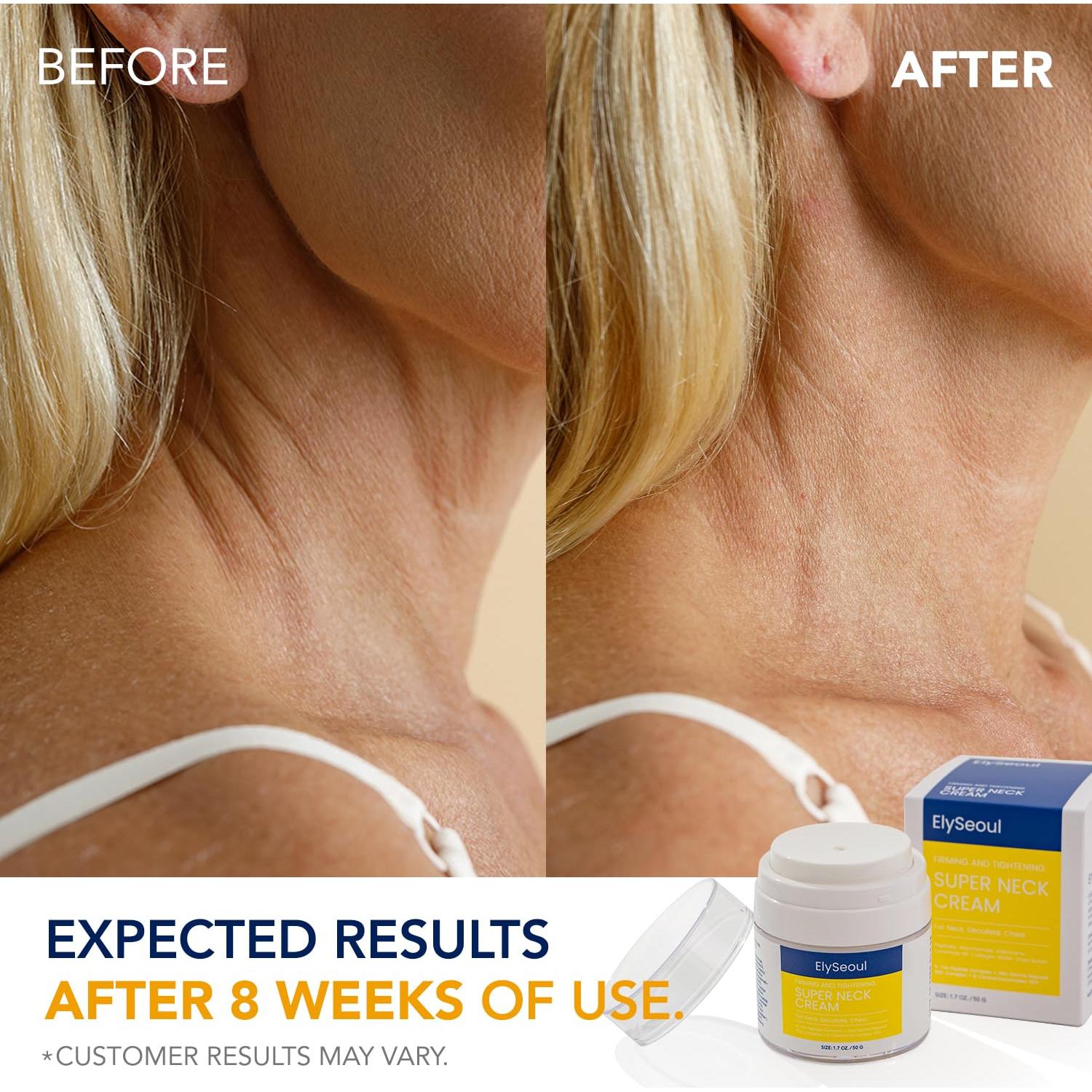 Crema Tensora para el Cuello EylSeoul 48g Antienvejecimiento