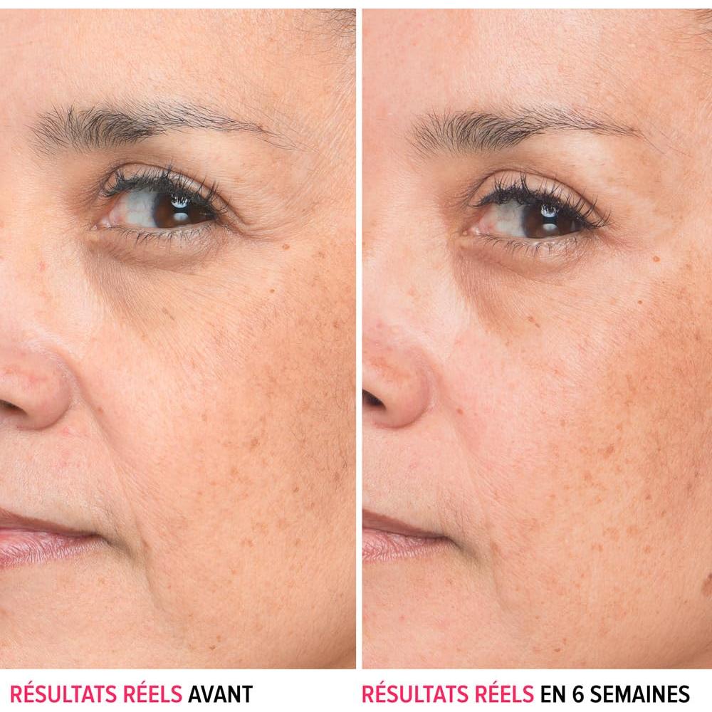 Suero de Ácido Hialurónico IT Cosmetics 29.57 ml - Hidratante