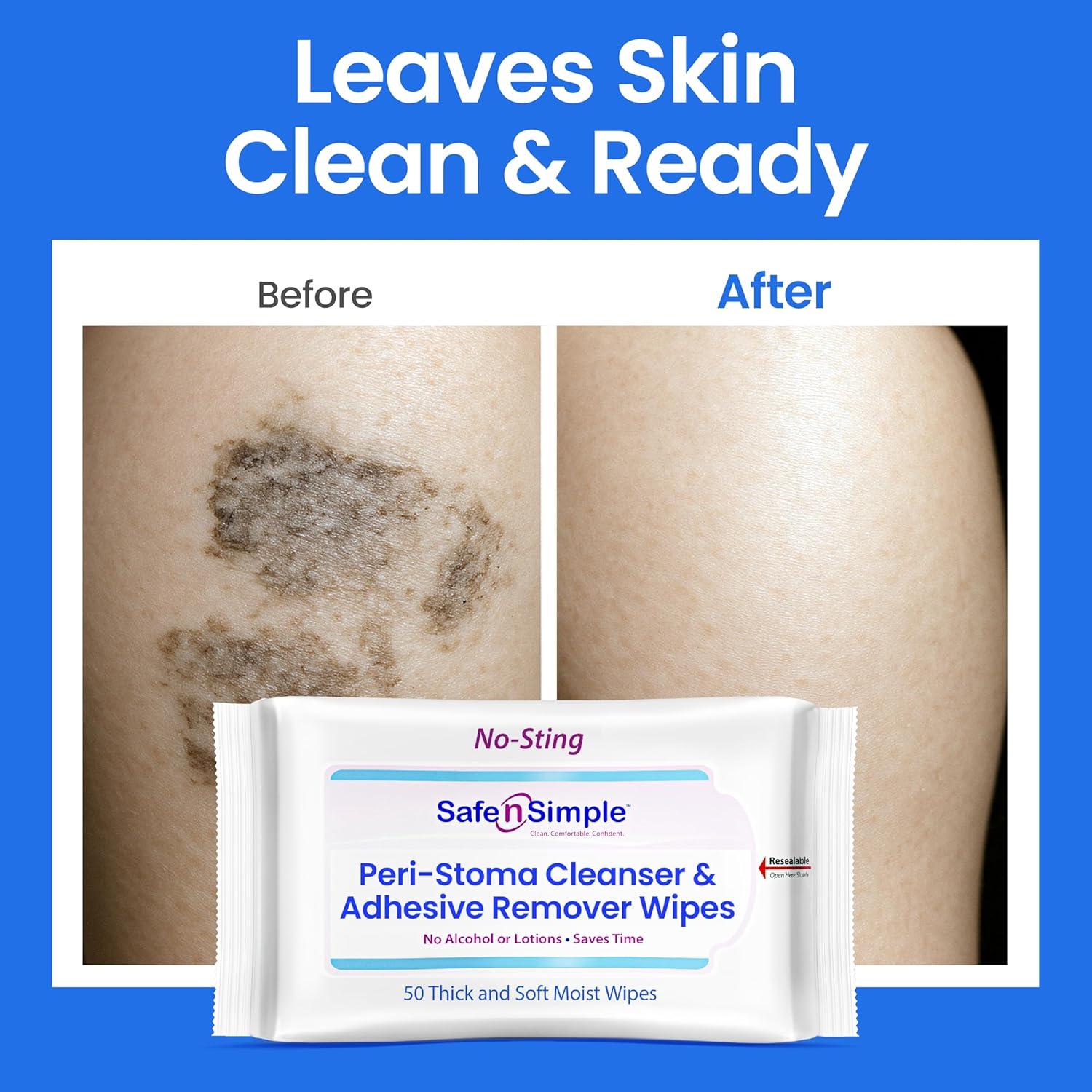 Toallitas Quit Adhesivo Safe n Simple - 50 Grandes Sin Alcohol