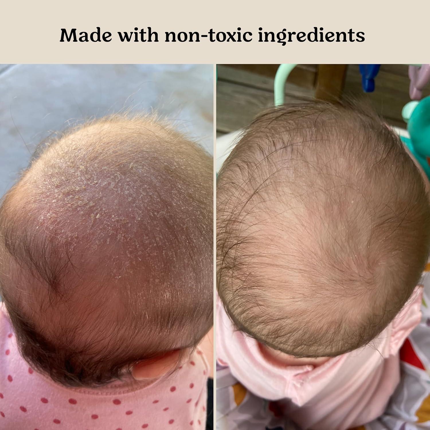 Aceite Hidratante para Bebé Roe Wellness 307g Sin Fragancia