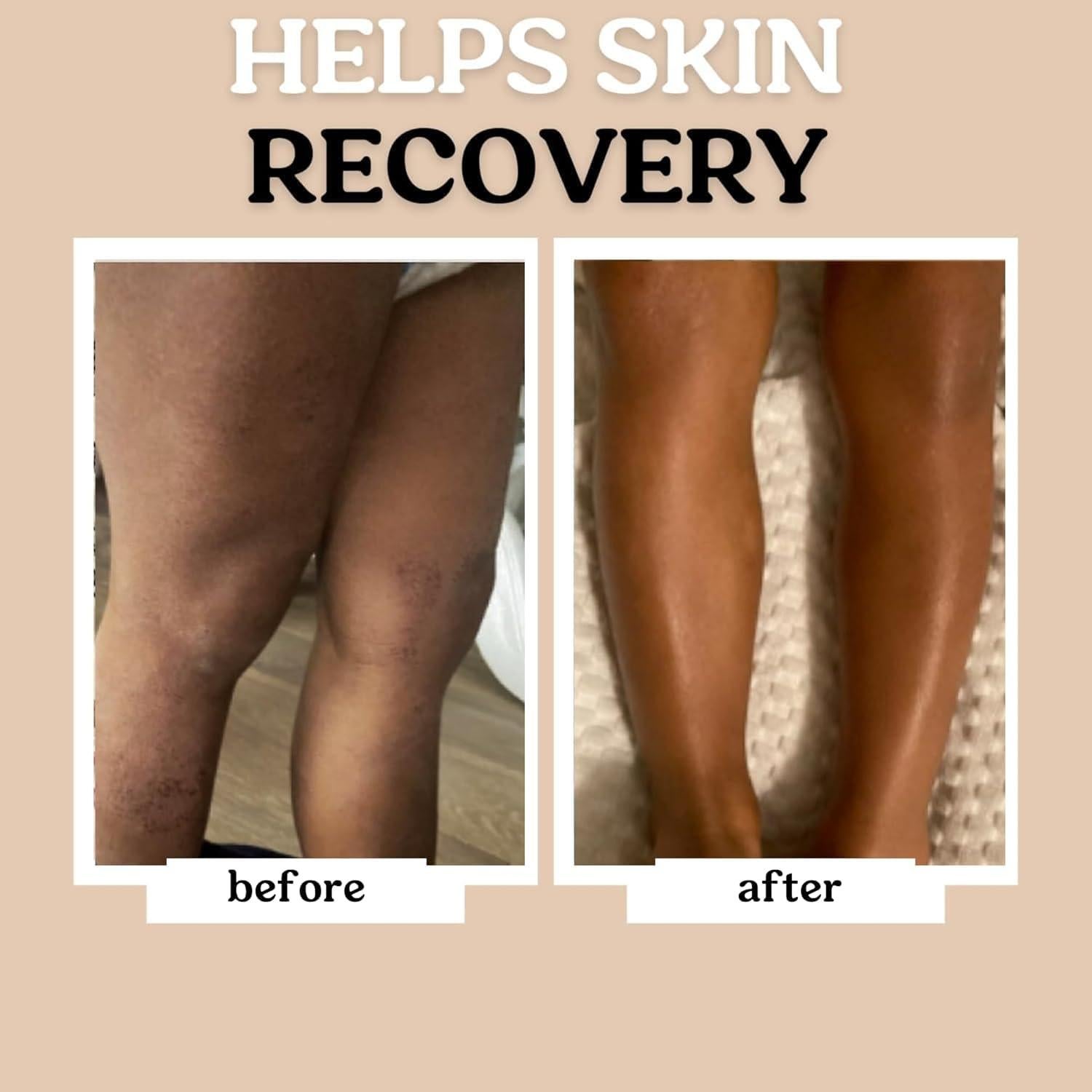 Aceite Hidratante para Bebé Roe Wellness 307g Sin Fragancia