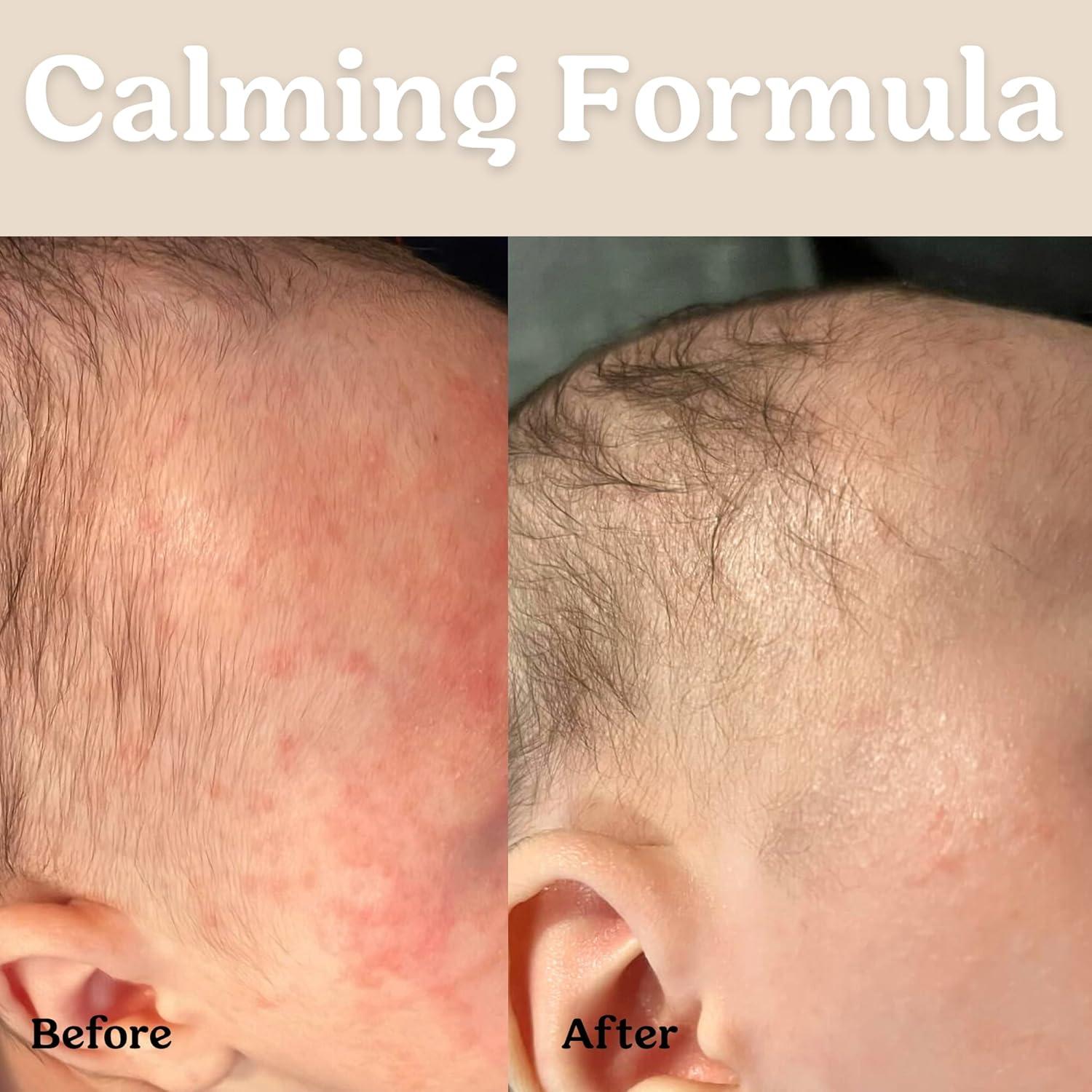 Aceite Hidratante para Bebé Roe Wellness 307g Sin Fragancia