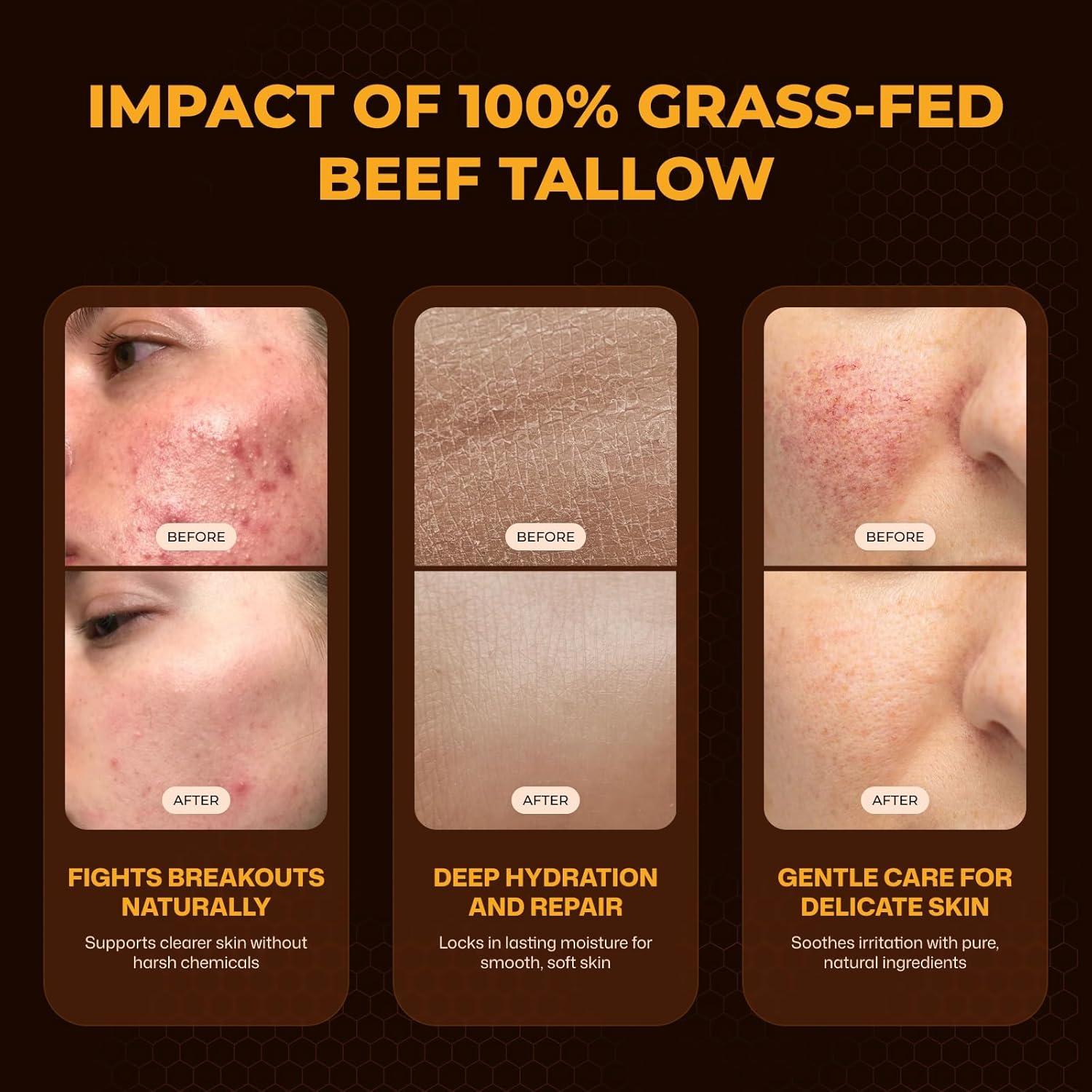 Bálsamo de Sebo y Miel VIORY 226g - Hidratante Natural Piel Sensible