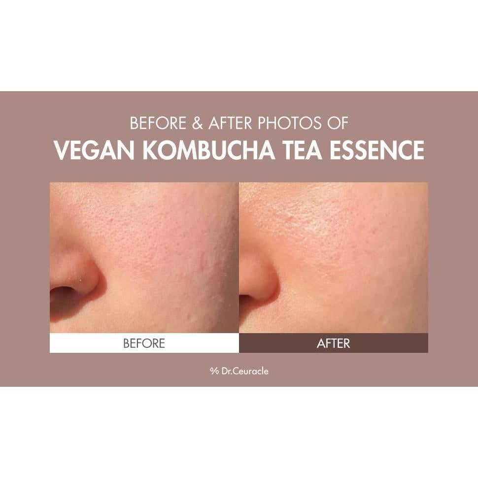 Tónico Hidratante Dr.Ceuracle Kombucha 150 ml Vegano