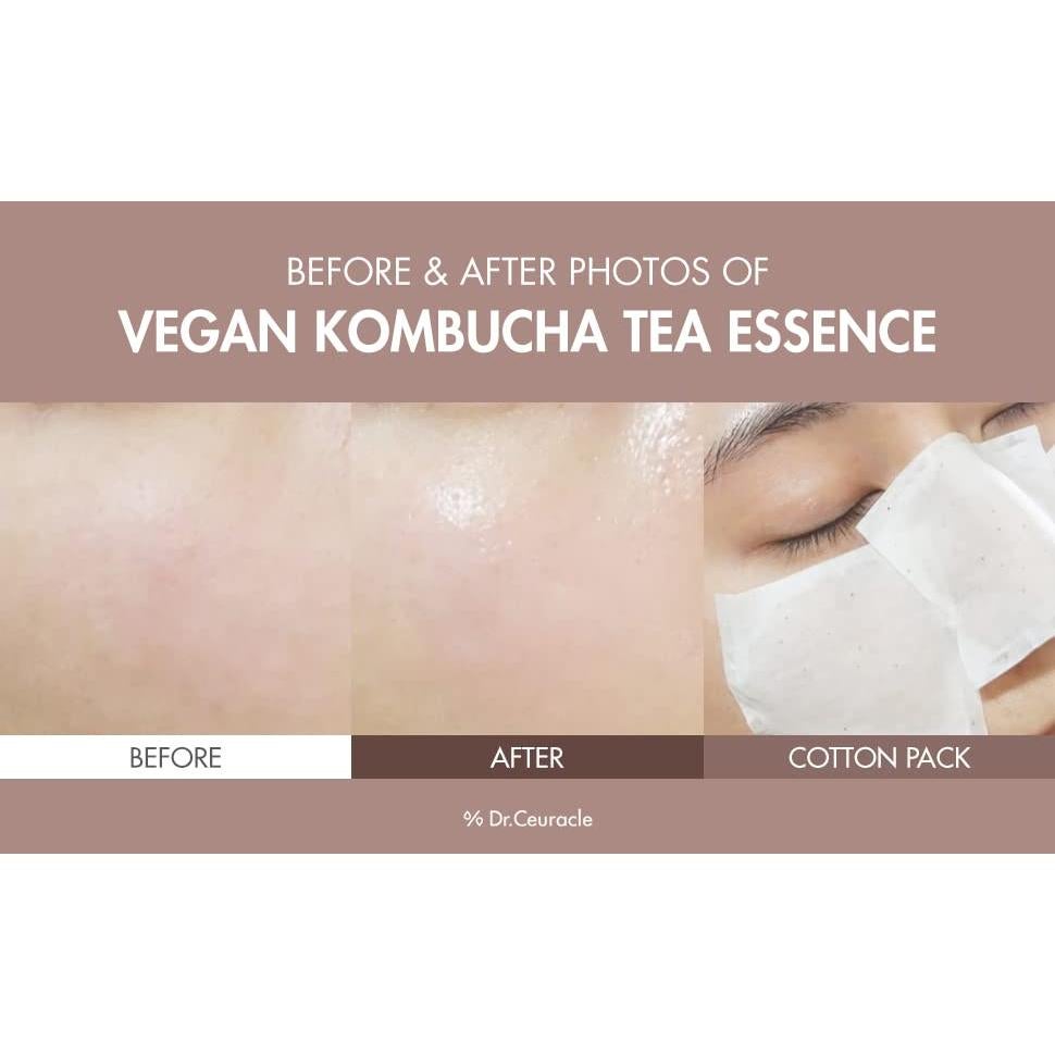 Tónico Hidratante Dr.Ceuracle Kombucha 150 ml Vegano