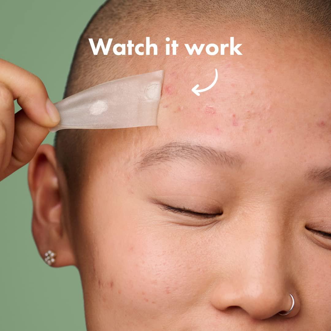 Mighty Patch Surface Hero Cosmetics - Parche acné XL 10 unidades