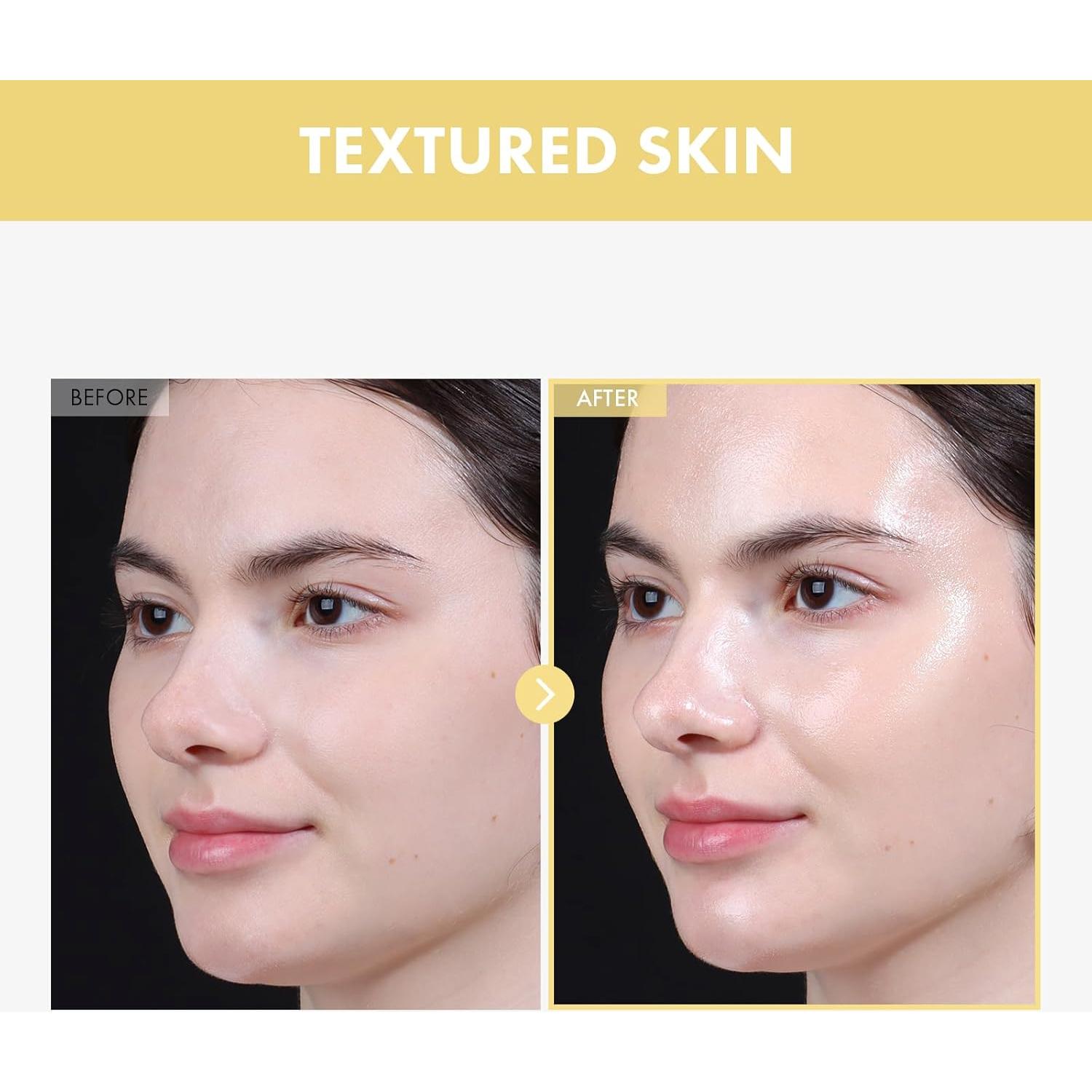 Esencia Facial Tosowoong Frijol Brillante 33ml Hidratante Exfoliante