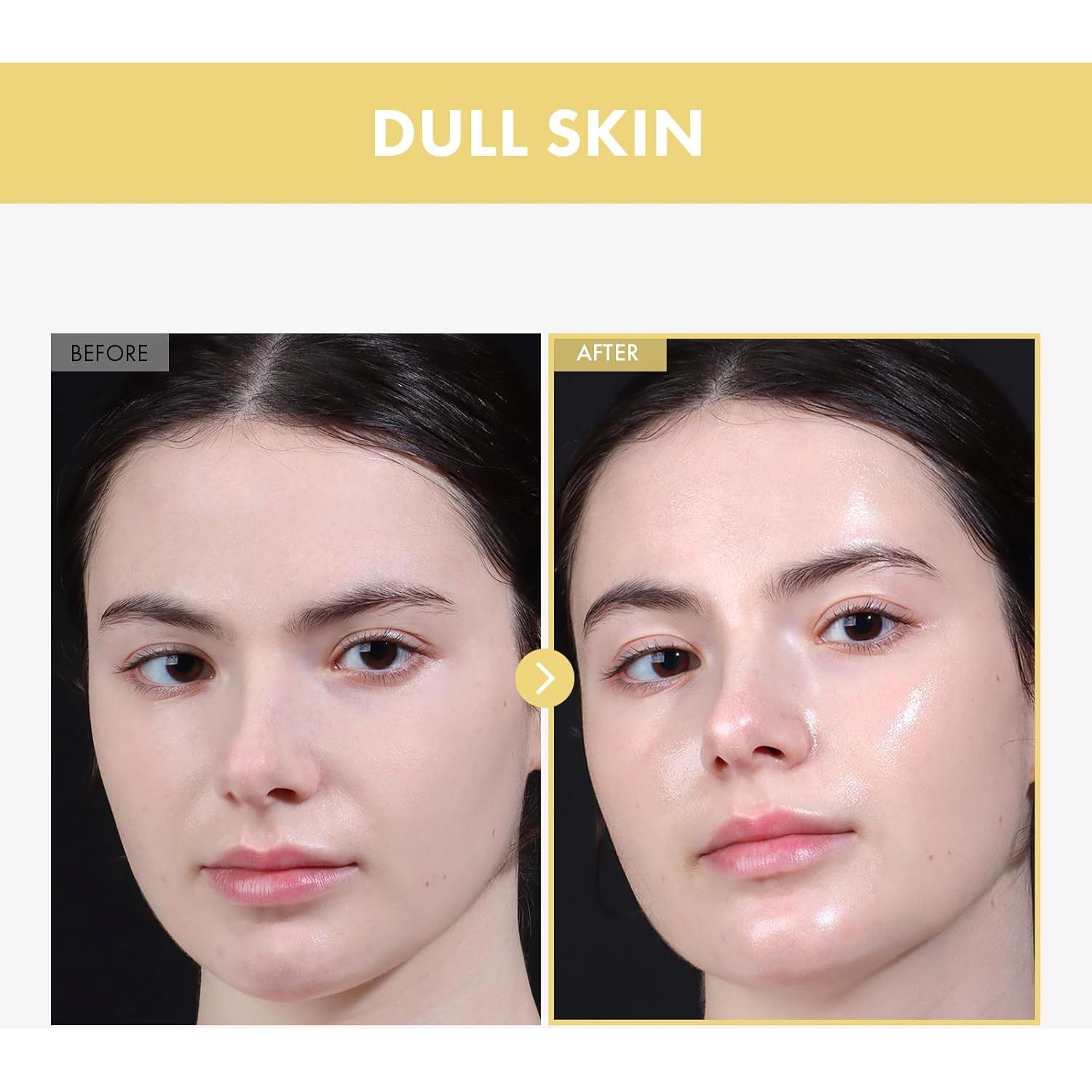 Esencia Facial Tosowoong Frijol Brillante 33ml Hidratante Exfoliante