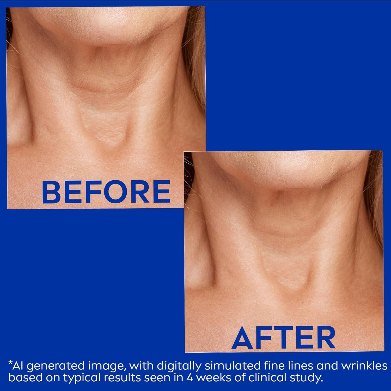 Crema reafirmante NIVEA para cuello y pecho 190 g Q10