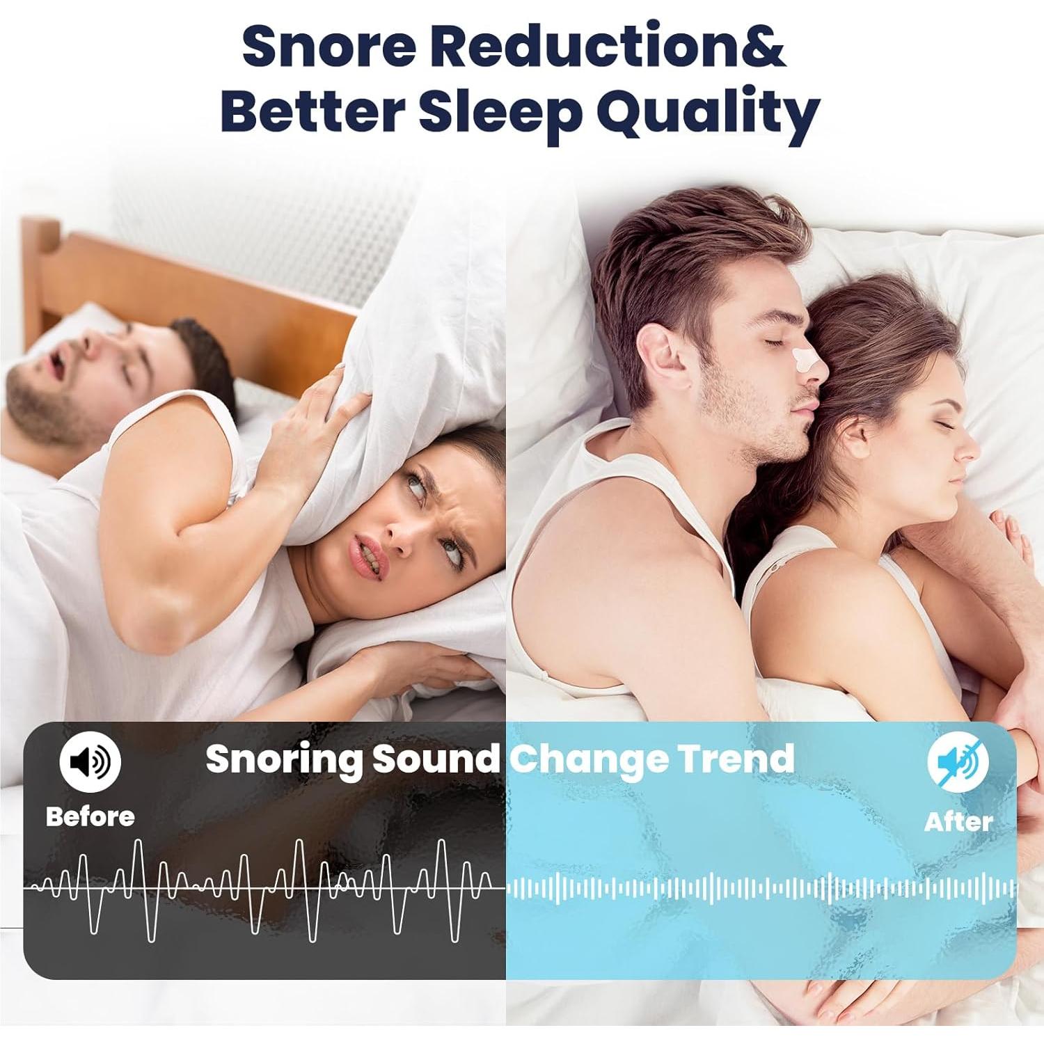 Tiras Nasales Eovvoe 30 Pcs Alivio Ronquidos Congestión