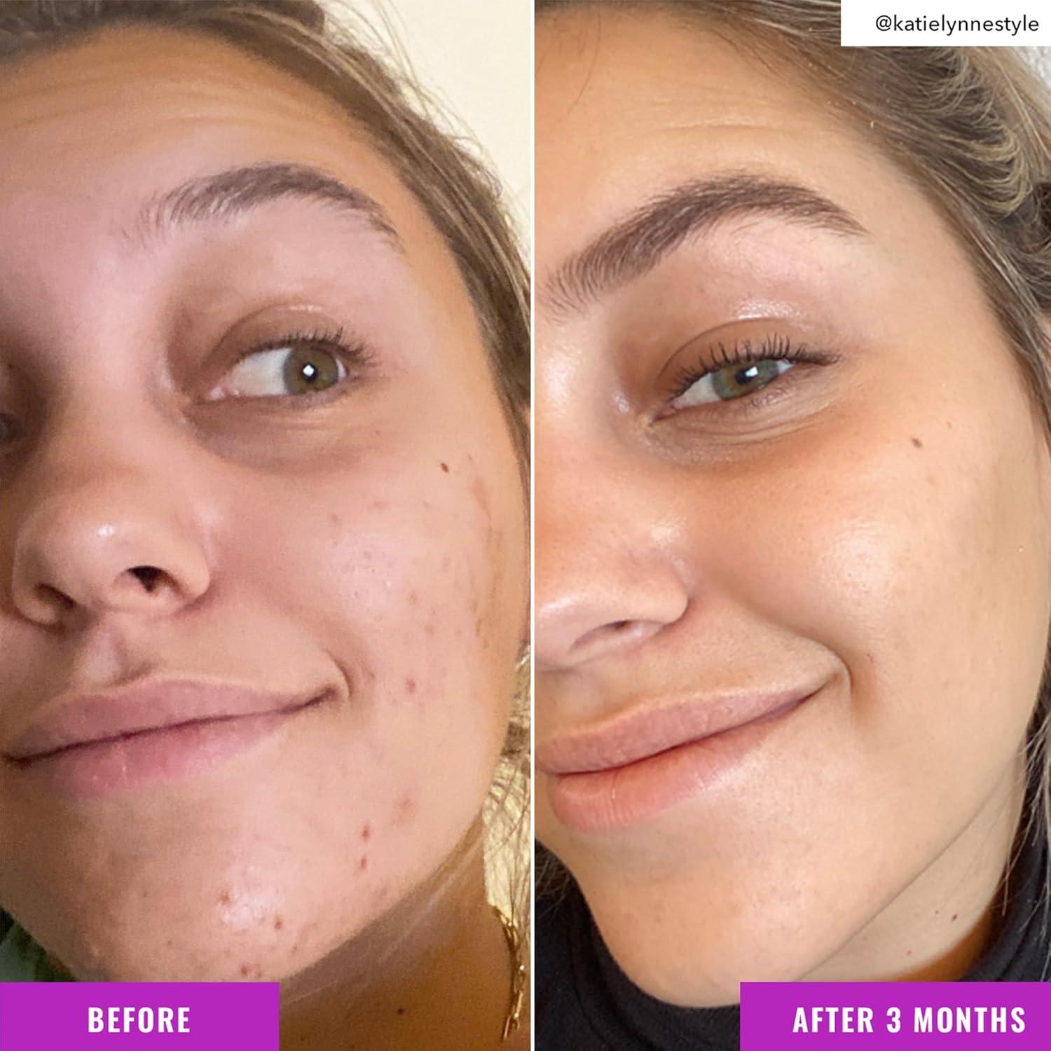 Tónico Iluminador Good Molecules 113ml Niacinamida y Vitamina C