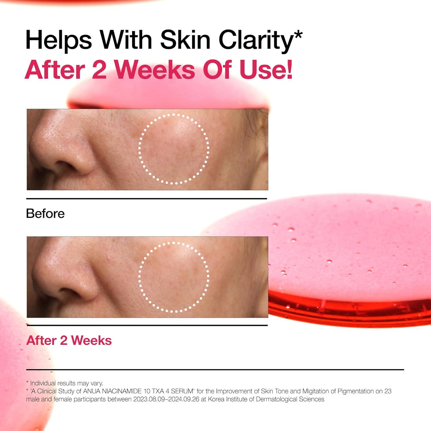 Suero Facial ANUA Niacinamida 10% y Ácido Tranexámico 30ml