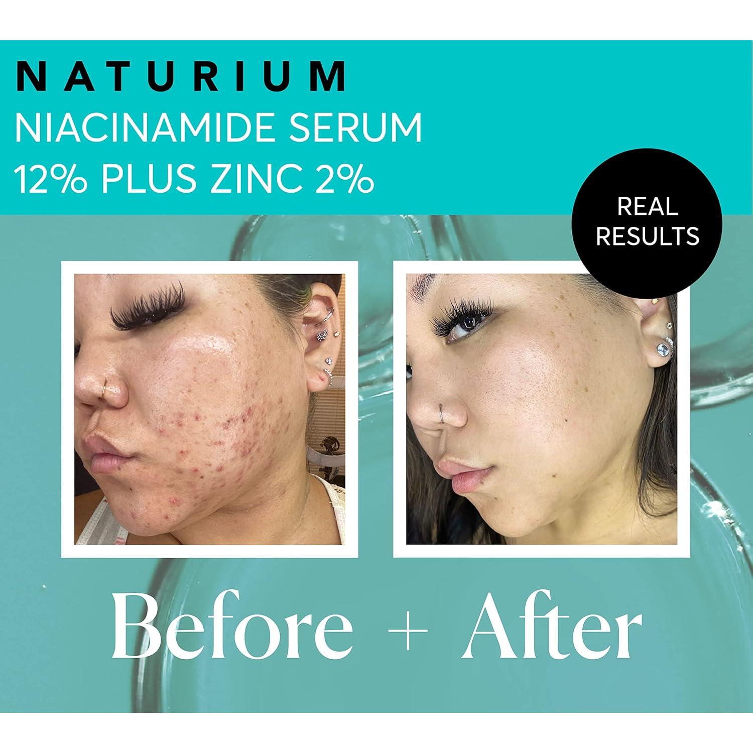 Suero Facial Naturium 12% Niacinamida y 2% Zinc 28g