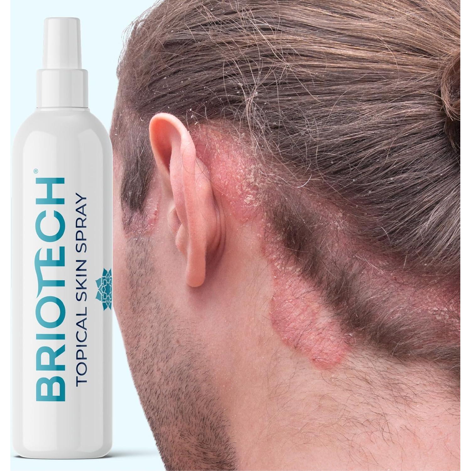 Spray Tópico Briotech HOCl 113 g para Piel y Cara