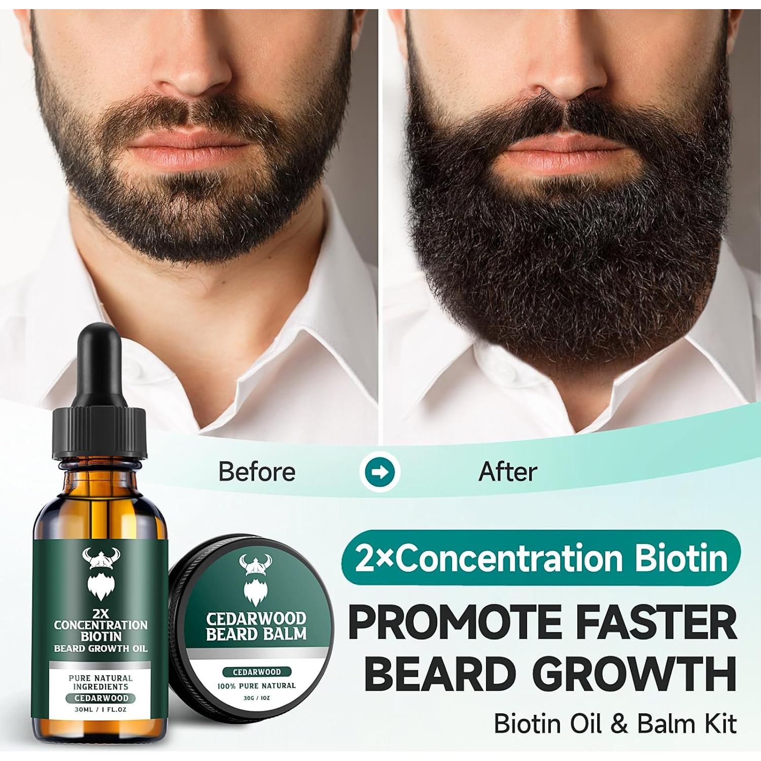 Kit de Crecimiento de Barba MistySprite 2X Biotina Aceites Naturales