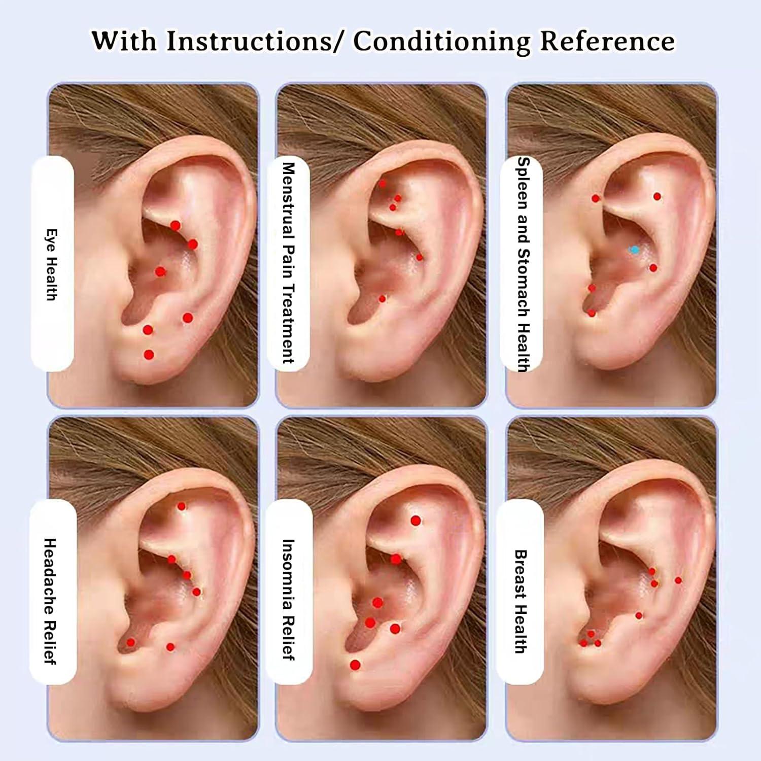 Kit de Acupuntura con Semillas de Oído Genérico - 20 Piezas
