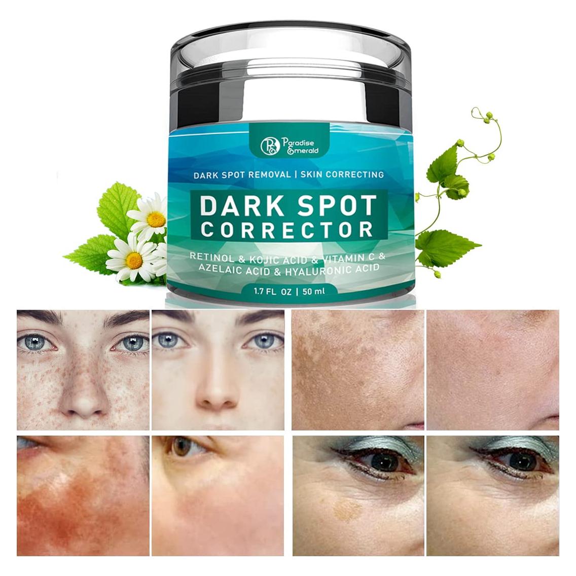 Removedor de Manchas Oscuras Paradise Emerald 48g - Hiperpigmentación