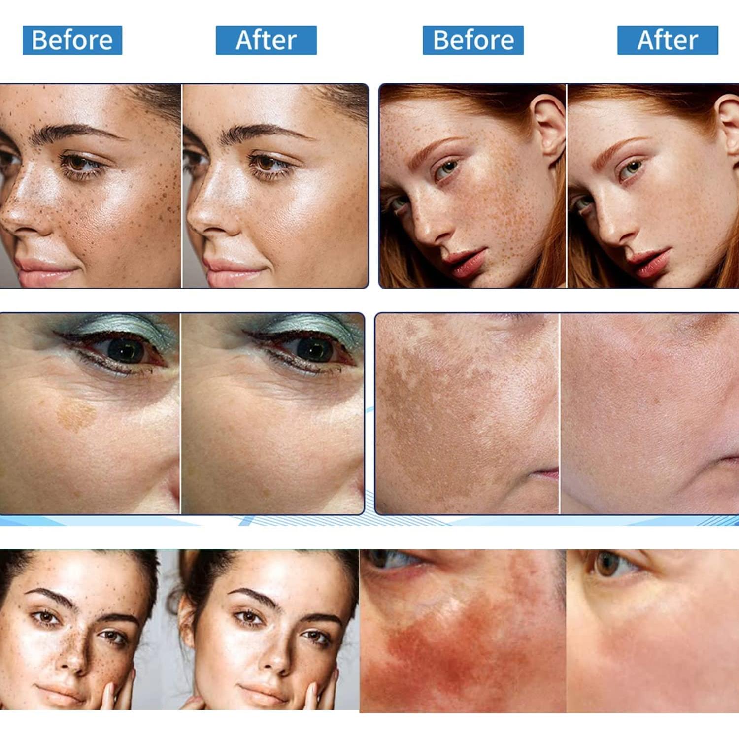 Removedor de Manchas Oscuras Paradise Emerald 48g - Hiperpigmentación