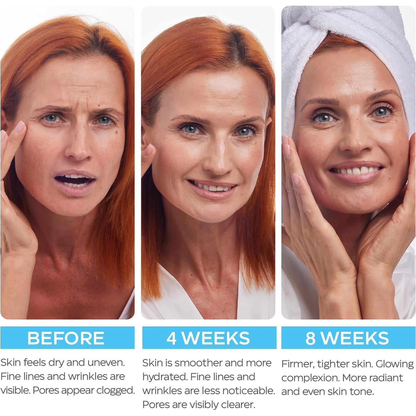 Crema Hidratante Antienvejecimiento MOONRIN con Retinol 52.6 g