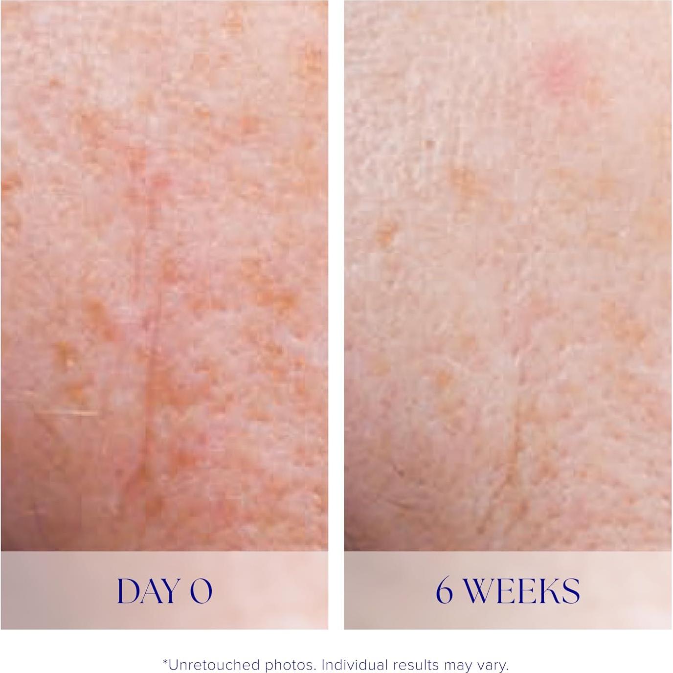 Suero Facial iS CLINICAL 15ml Antienvejecimiento Piel Perfecta