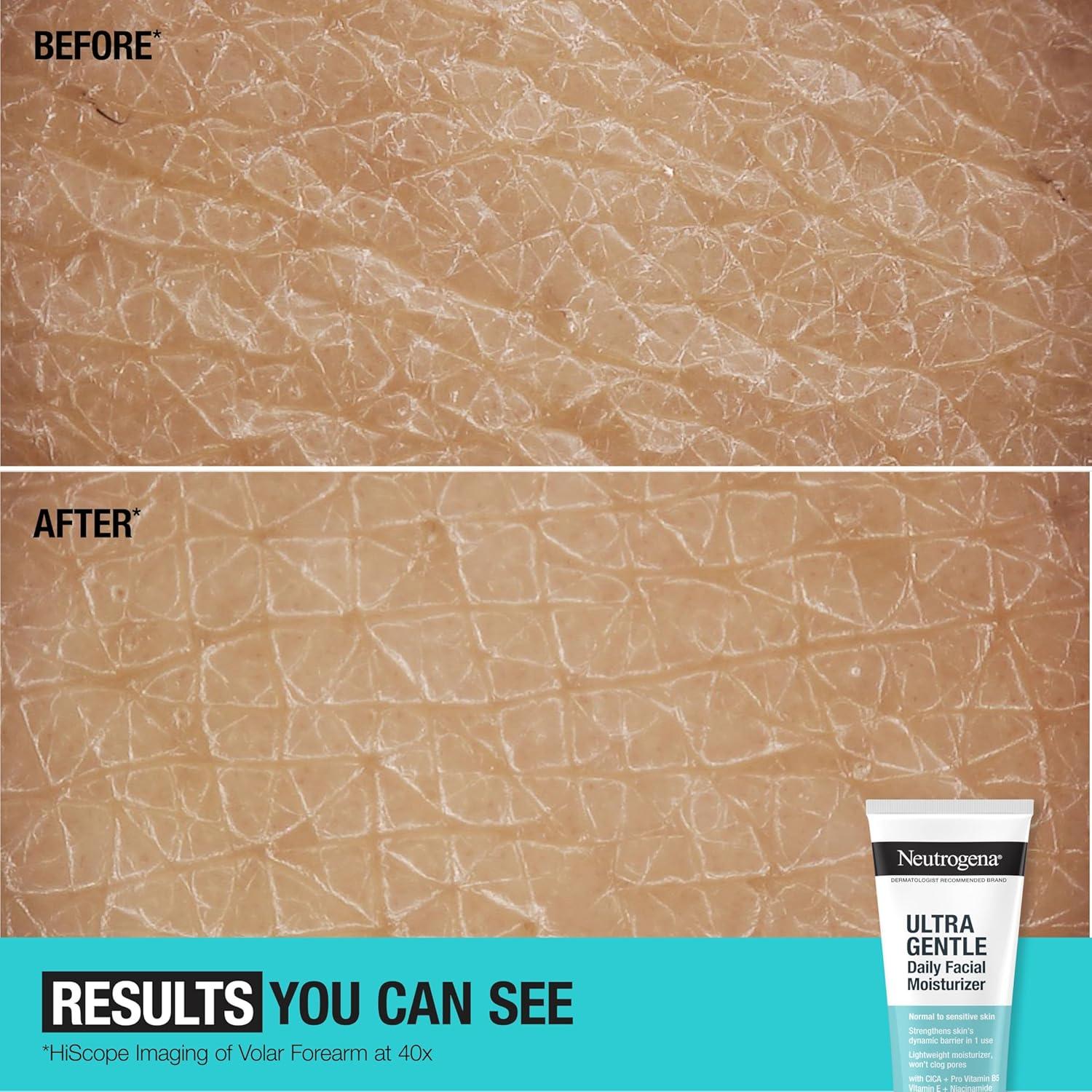 Hidratante Facial Diario Neutrogena 100 ml Sin Fragancia Piel Sensible