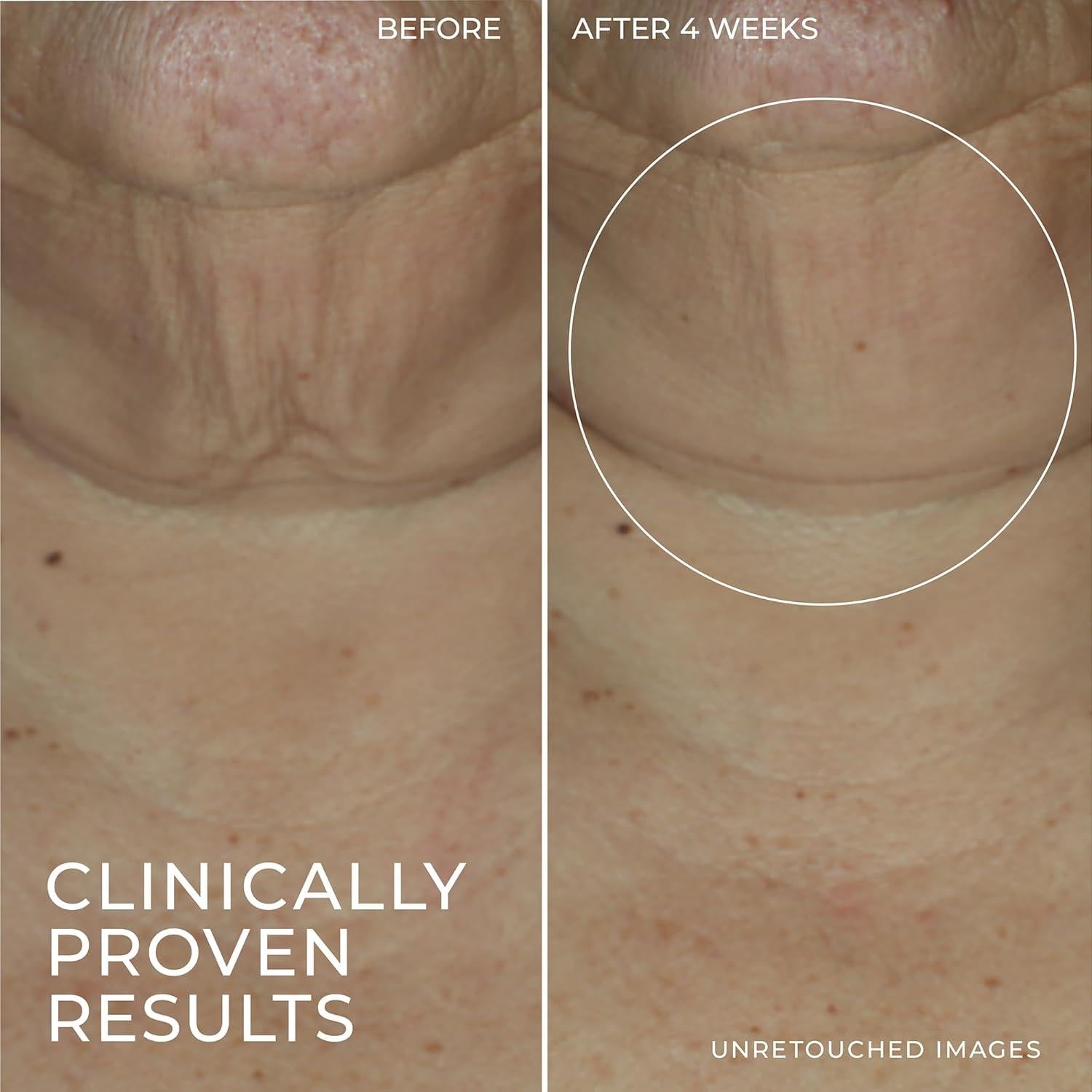 Suero en Barra Reafirmante RoC Derm Correxion con Retinol 28.35g