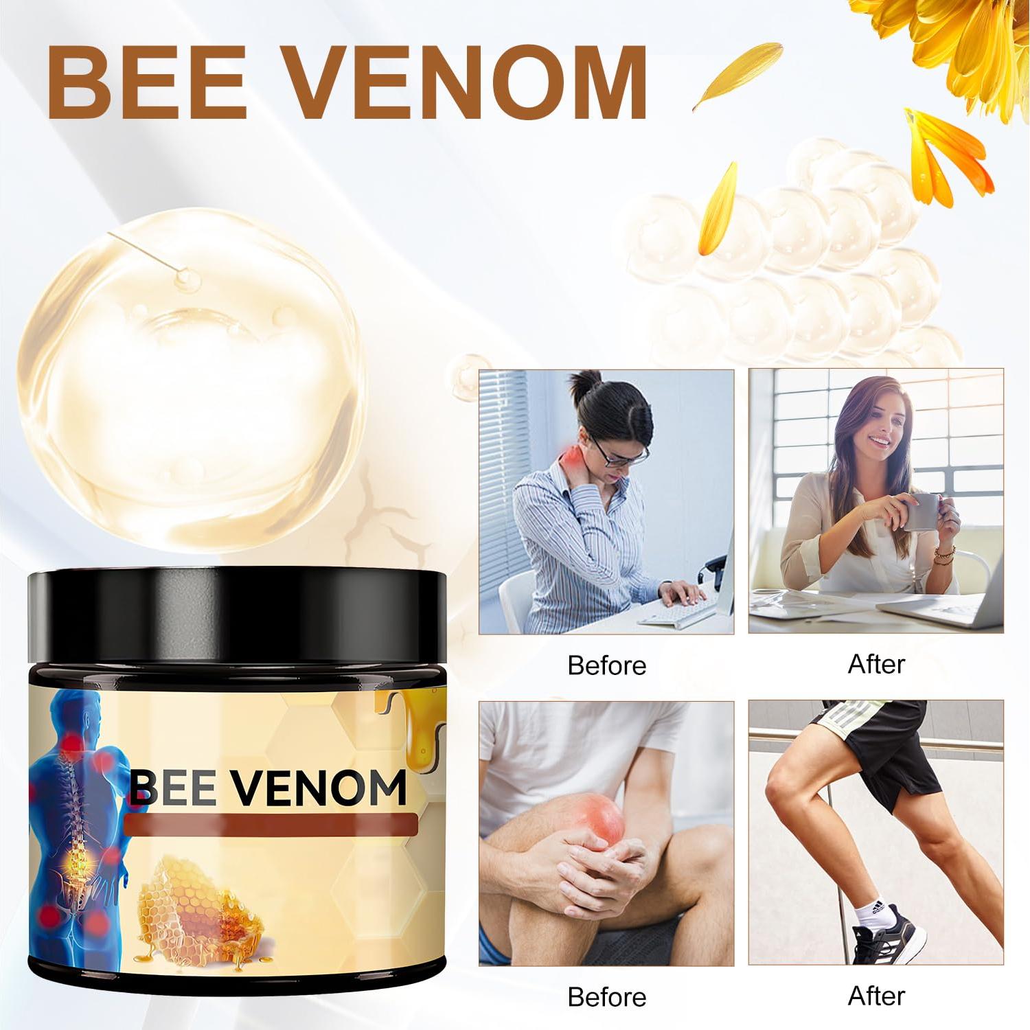 Crema de Veneno de Abeja Egmsic 2PCS para Articulaciones 170g