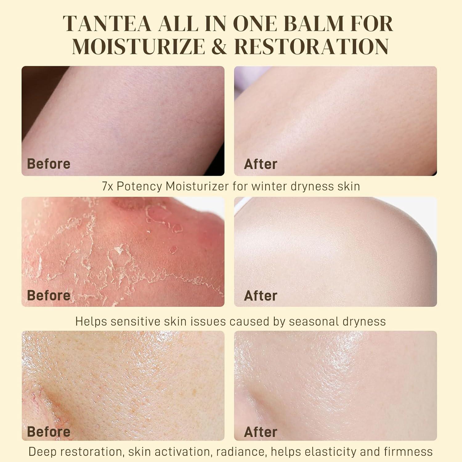 Grasa de Res con Veneno de Abeja 100% Natural 132g