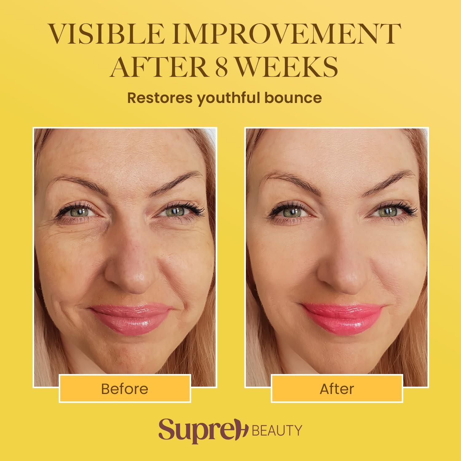 Crema Antiarrugas Veneno de Abeja SupreH 50 ml - Ácido Hialurónico