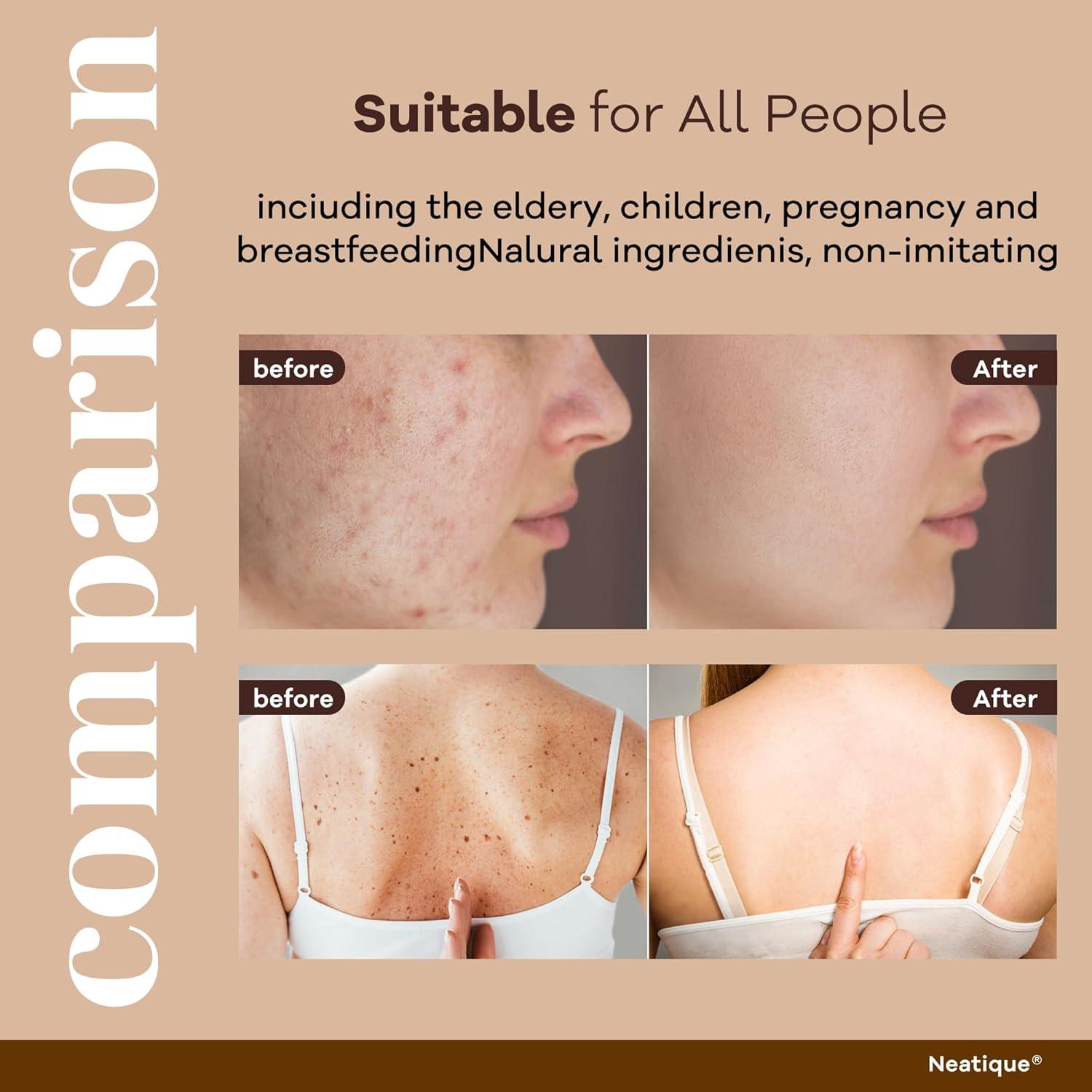 Crema Facial Anti-Envejecimiento Neatique con Veneno de Abeja 60g