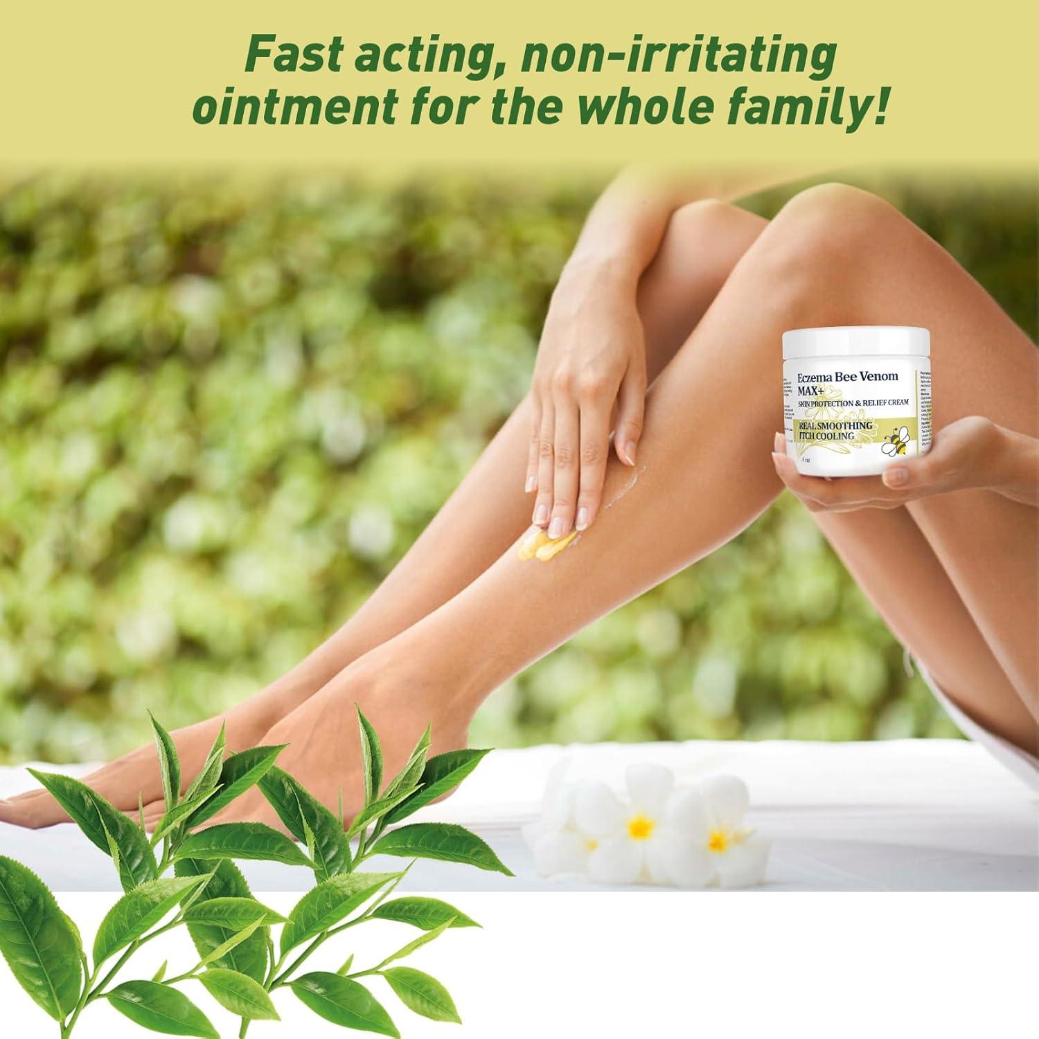 Crema de Veneno de Abeja DUBOONAIO para Eccema y Psoriasis 56g