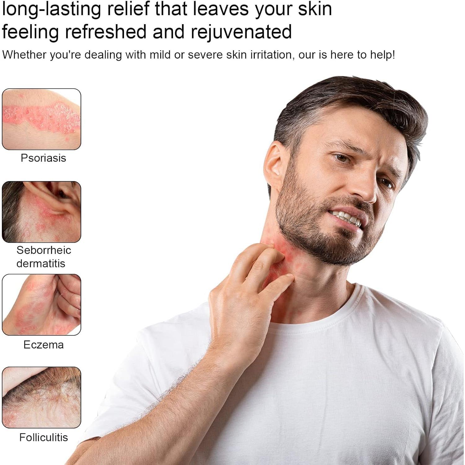 Crema de Veneno de Abeja DUBOONAIO para Eccema y Psoriasis 56g