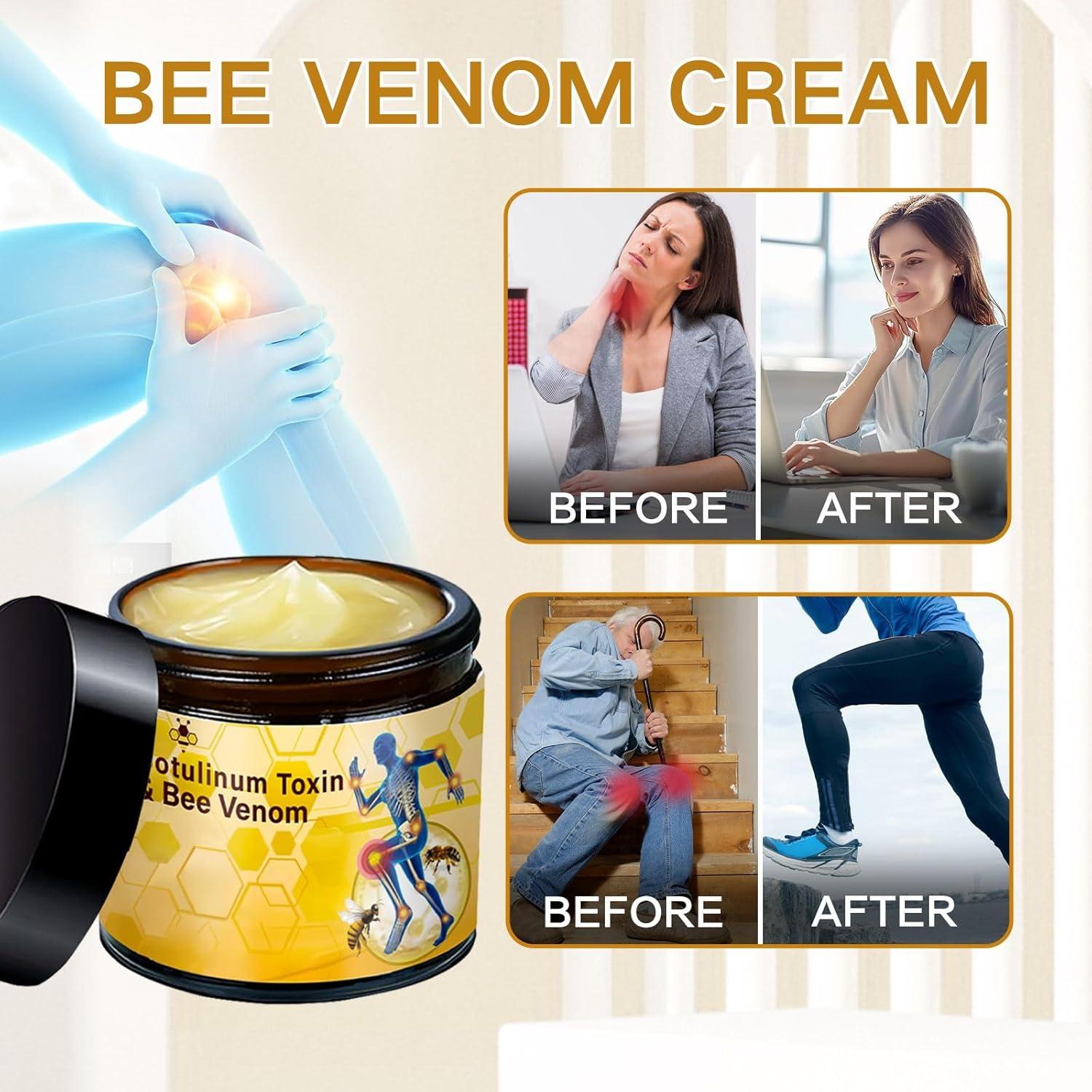Crema Articular de Veneno de Abeja YOUTINGH 2PCS 167g