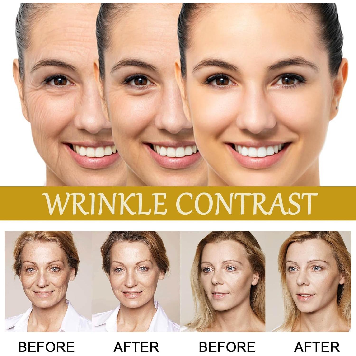 Suero Antiarrugas Veneno de Abeja Avanzado 15ml - 2 Piezas