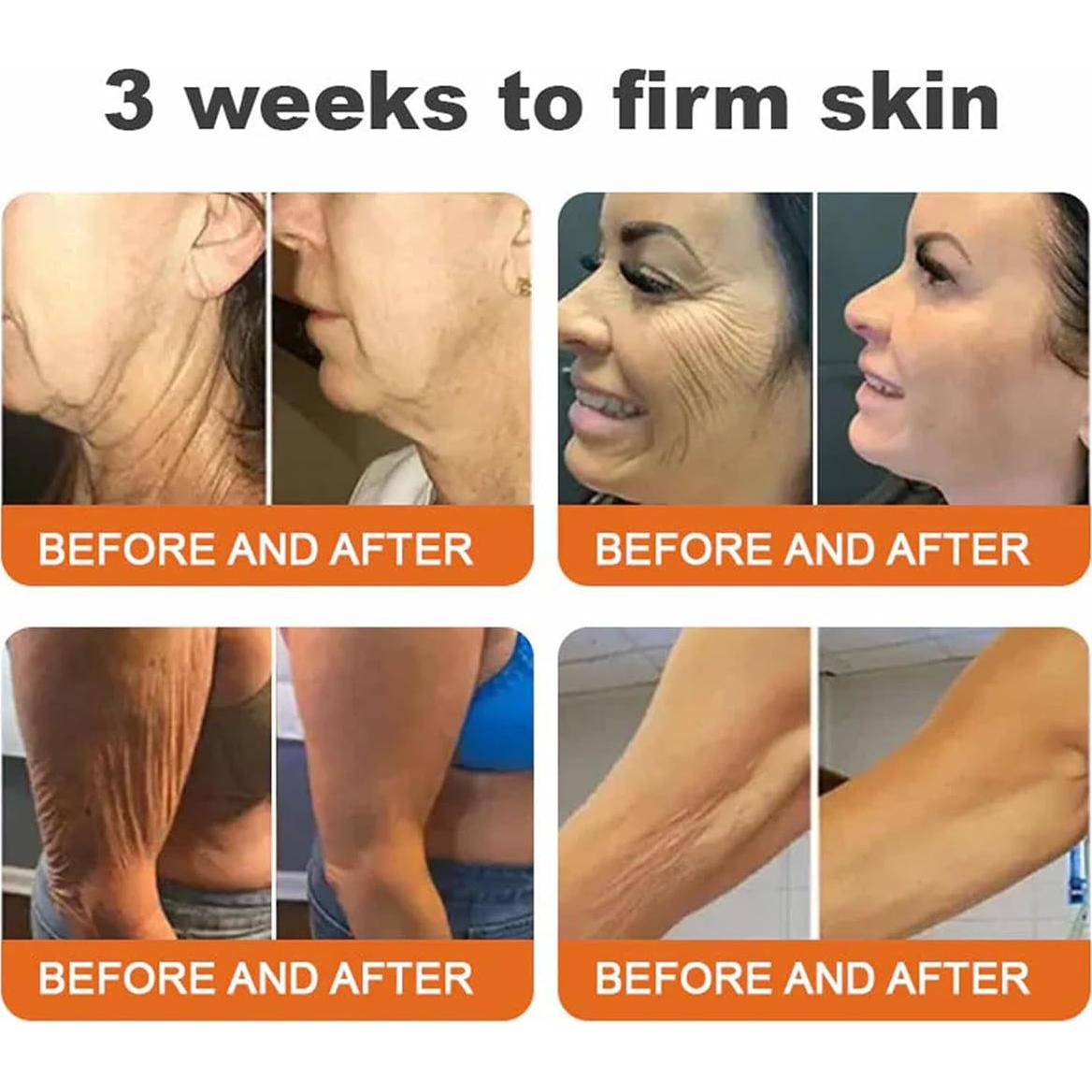 Suero en Barra Reafirmante Gaukomzs con Veneno de Abeja 132g