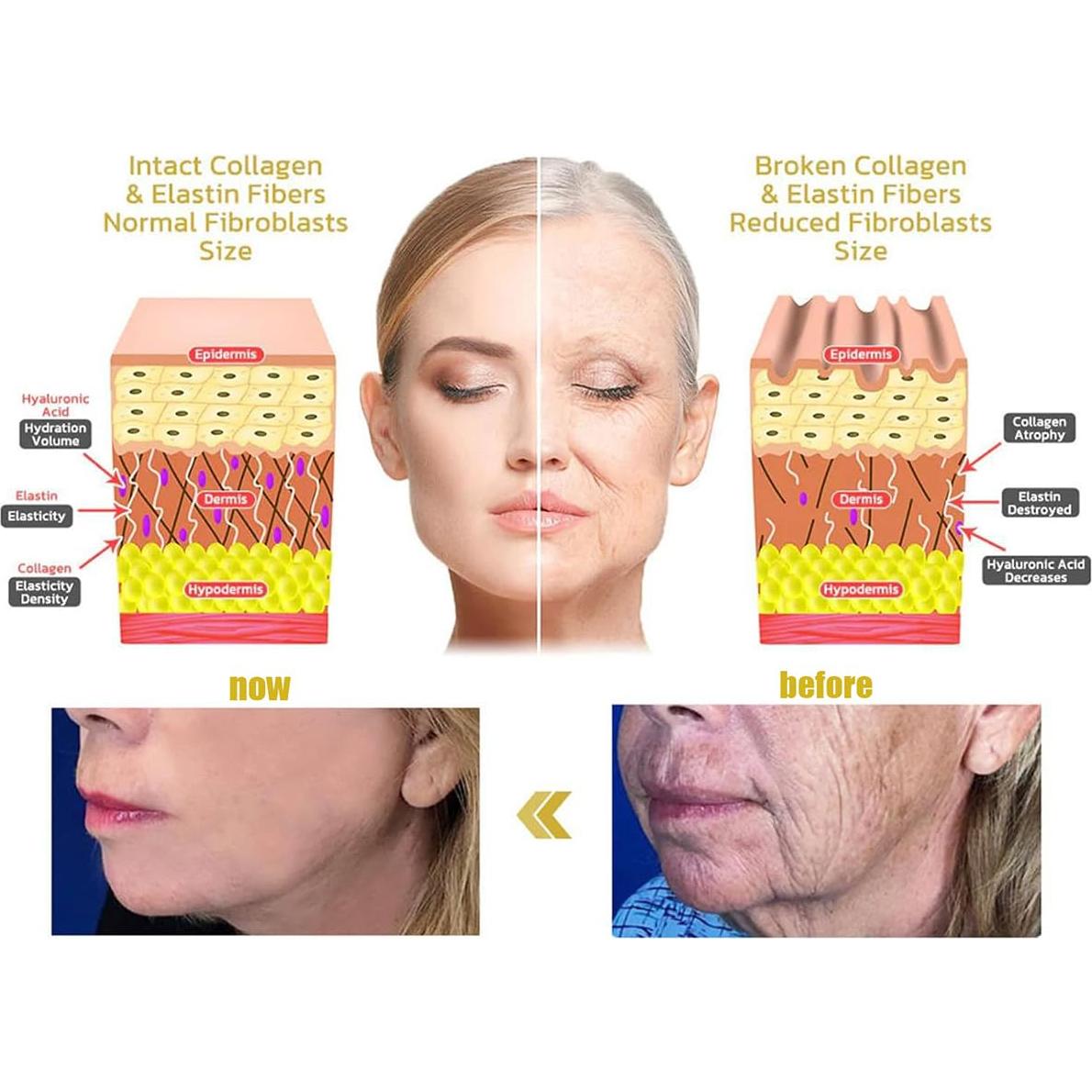Suero en Barra Reafirmante Gaukomzs con Veneno de Abeja 132g