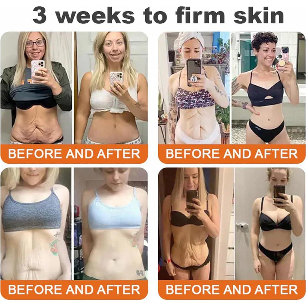 Suero en Barra Reafirmante Gaukomzs con Veneno de Abeja 132g