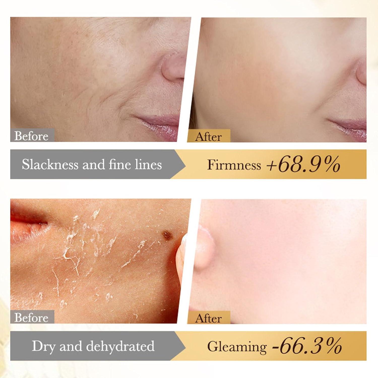 Mascarilla Facial Antienvejecimiento Veneno de Abeja ARCHIDATE 200g