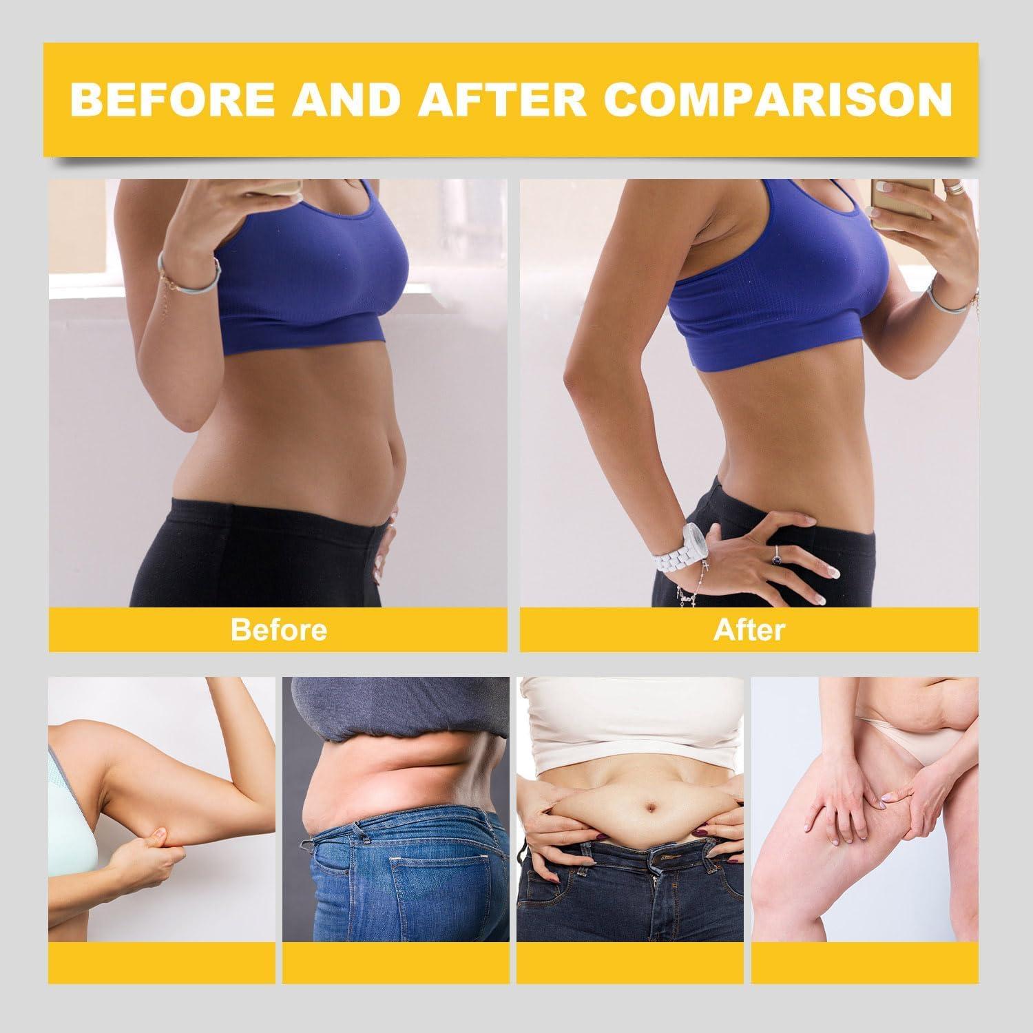 Parches de Veneno de Abeja Rednow - 30 Piezas Naturales