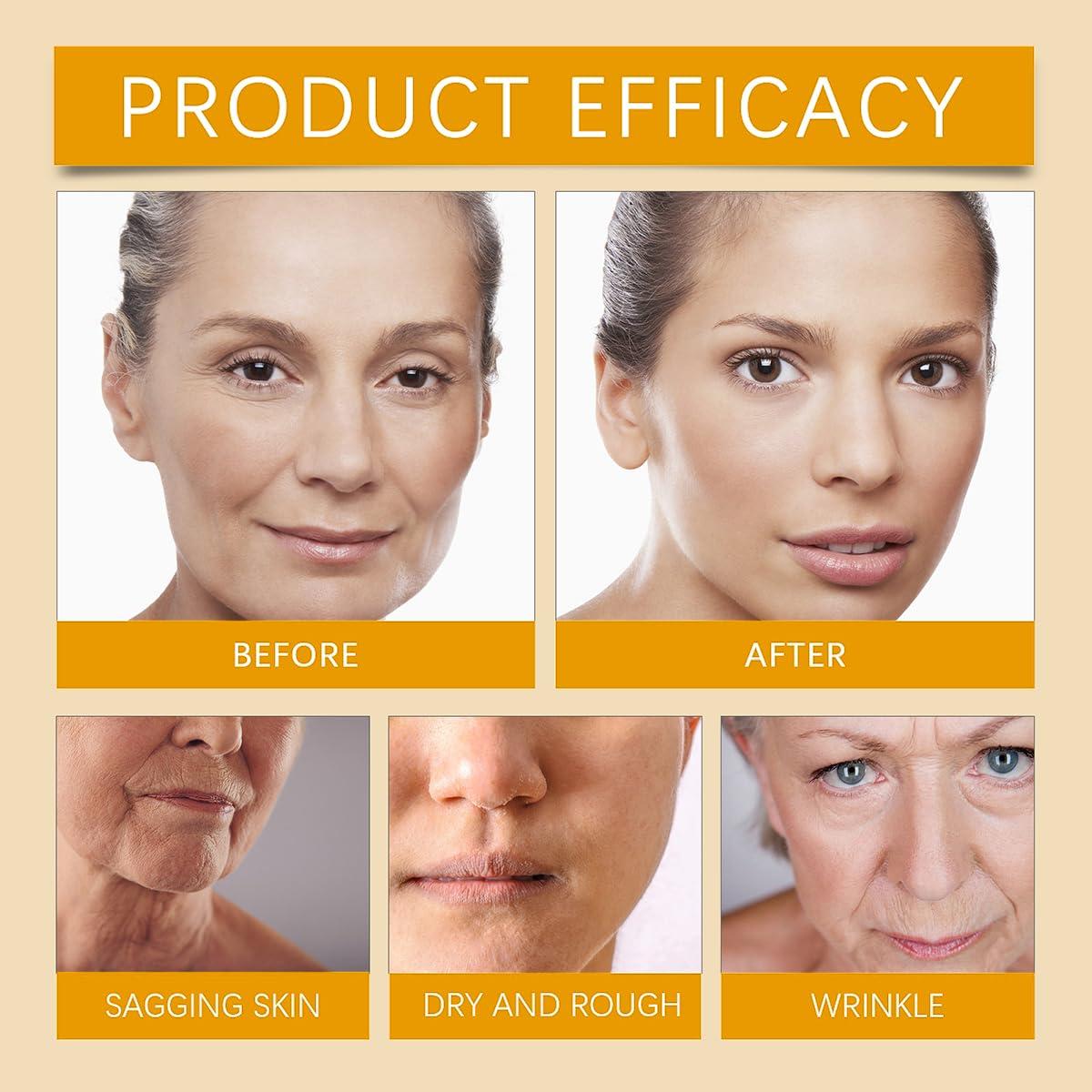 Crema Hidratante de Veneno de Abeja FYEBOO 20.1 g - 2 Paquetes