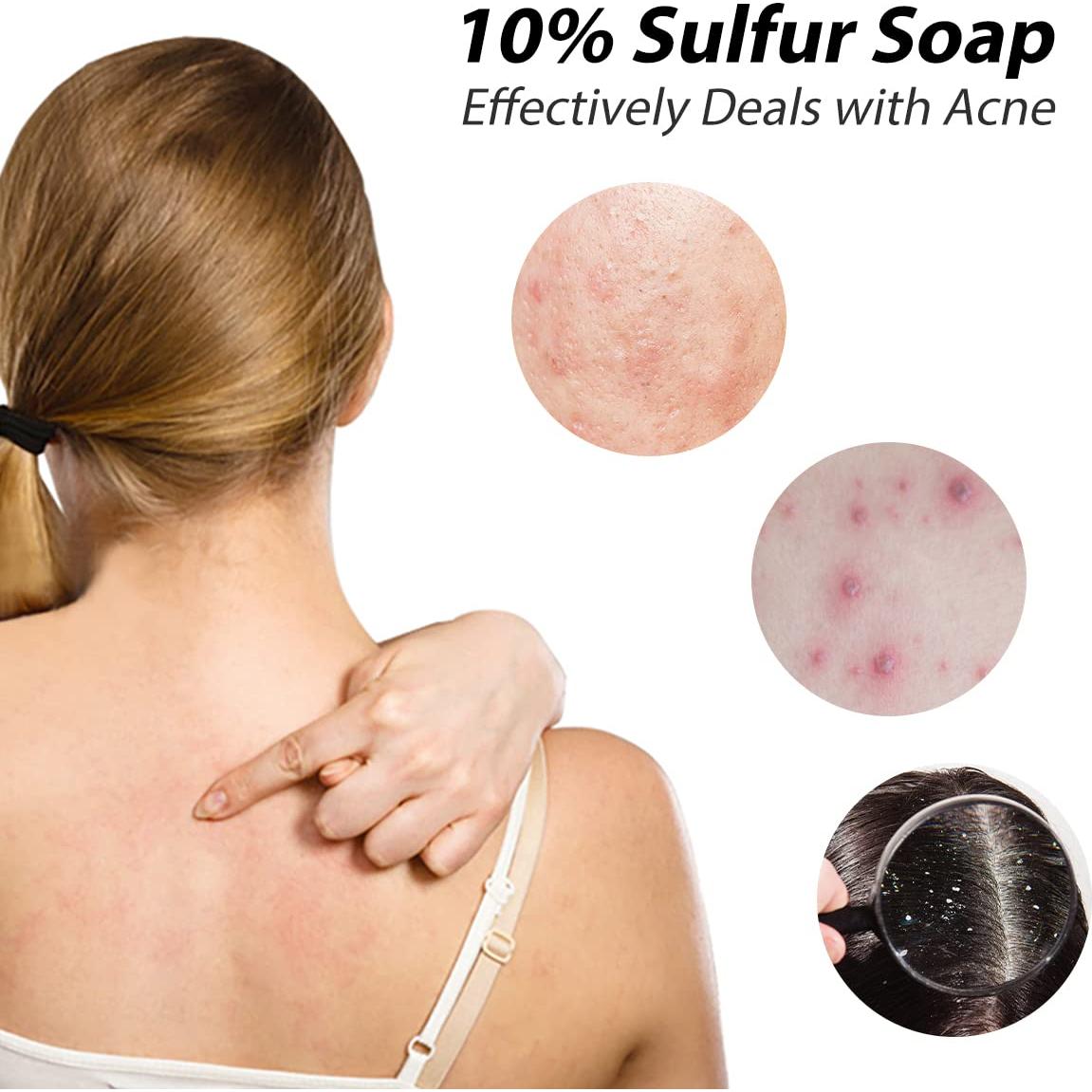 Jabón de Azufre Bee & Flower 10% 96.4 g - Tratamiento Acné